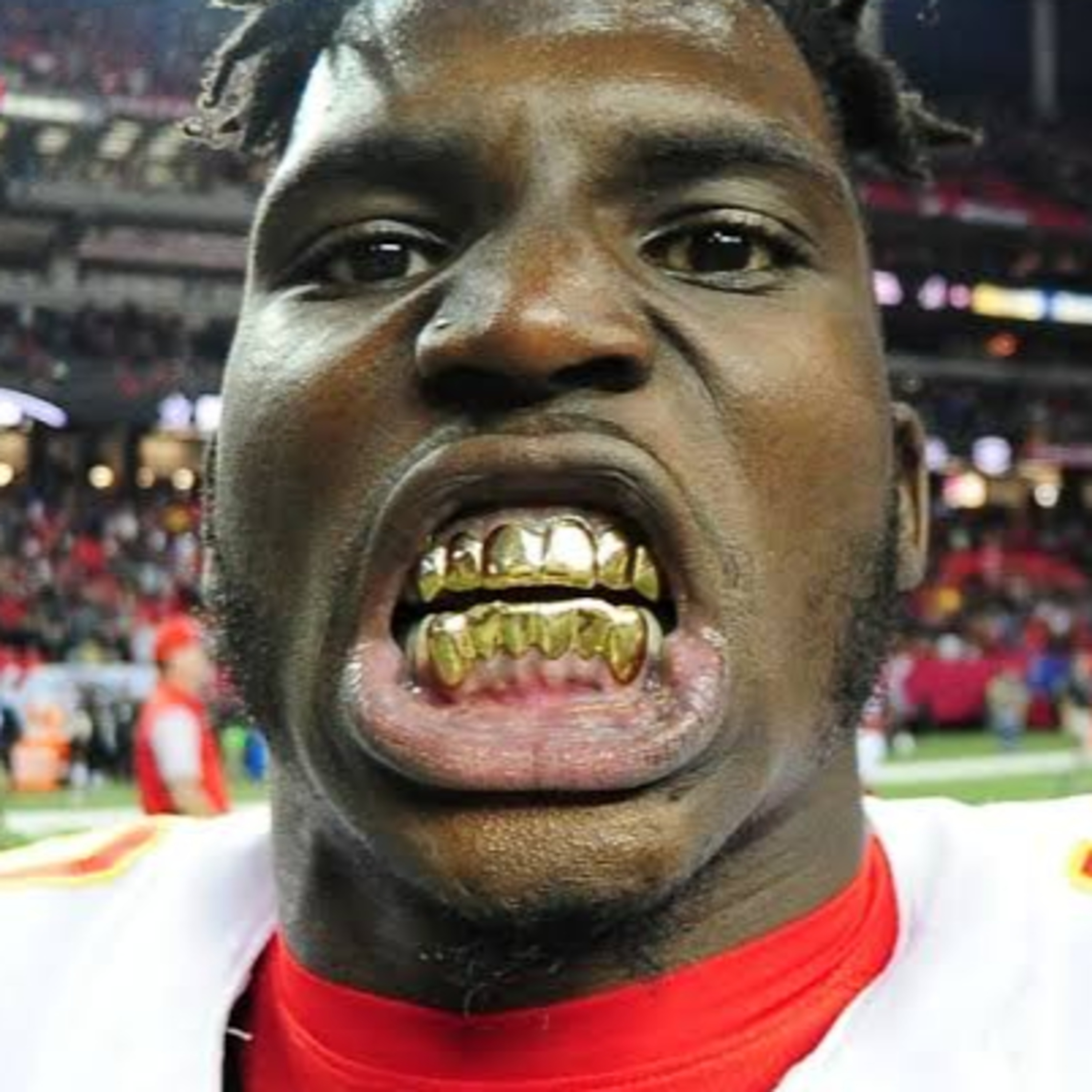 Tyreek Hill: $4 Million Dollars In Child Support - 7 Kids Possibly By 5 Different Women! (Men Are The Resource) episode artwork
