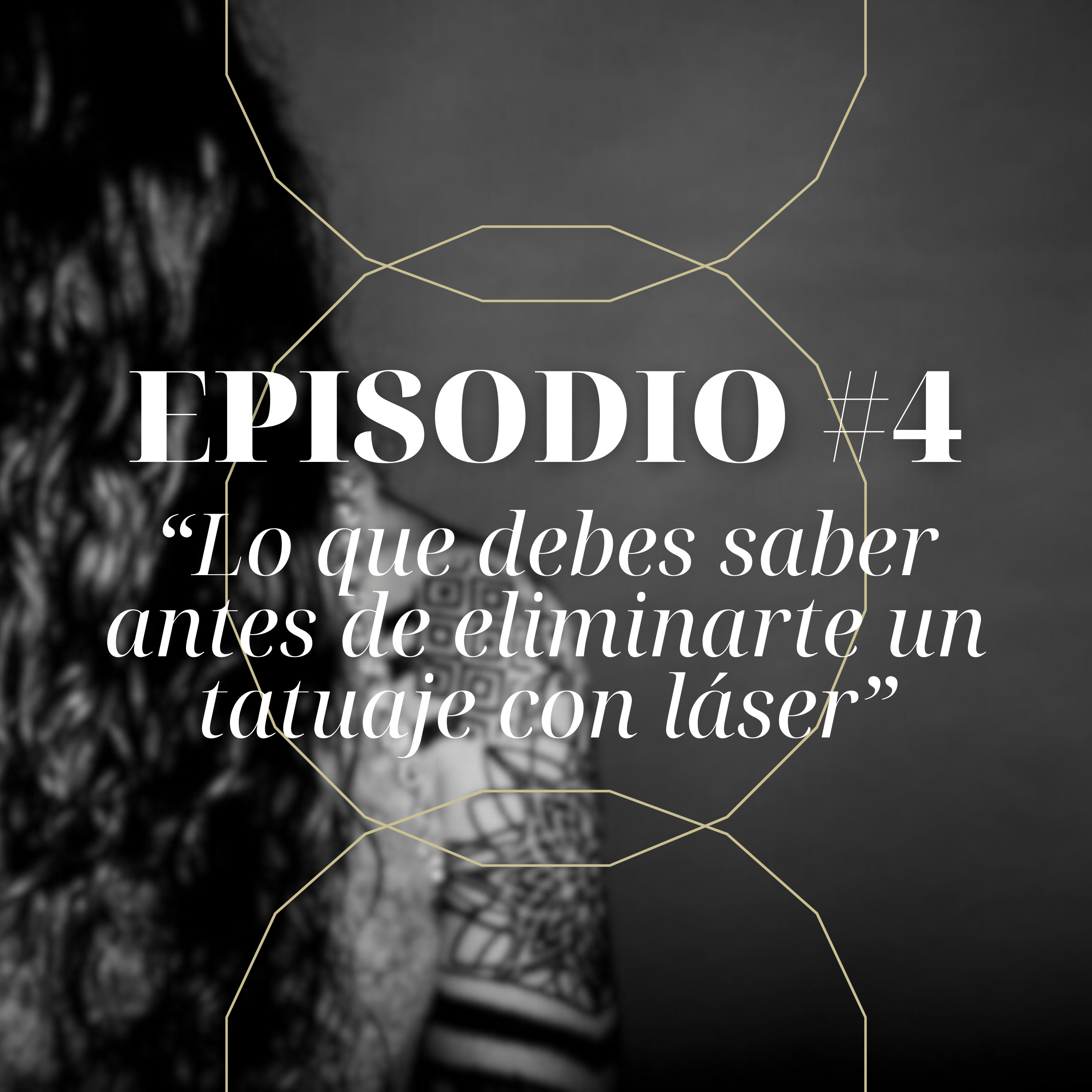 #4 Lo que debes saber antes de eliminarte un tatuaje con láser episode artwork