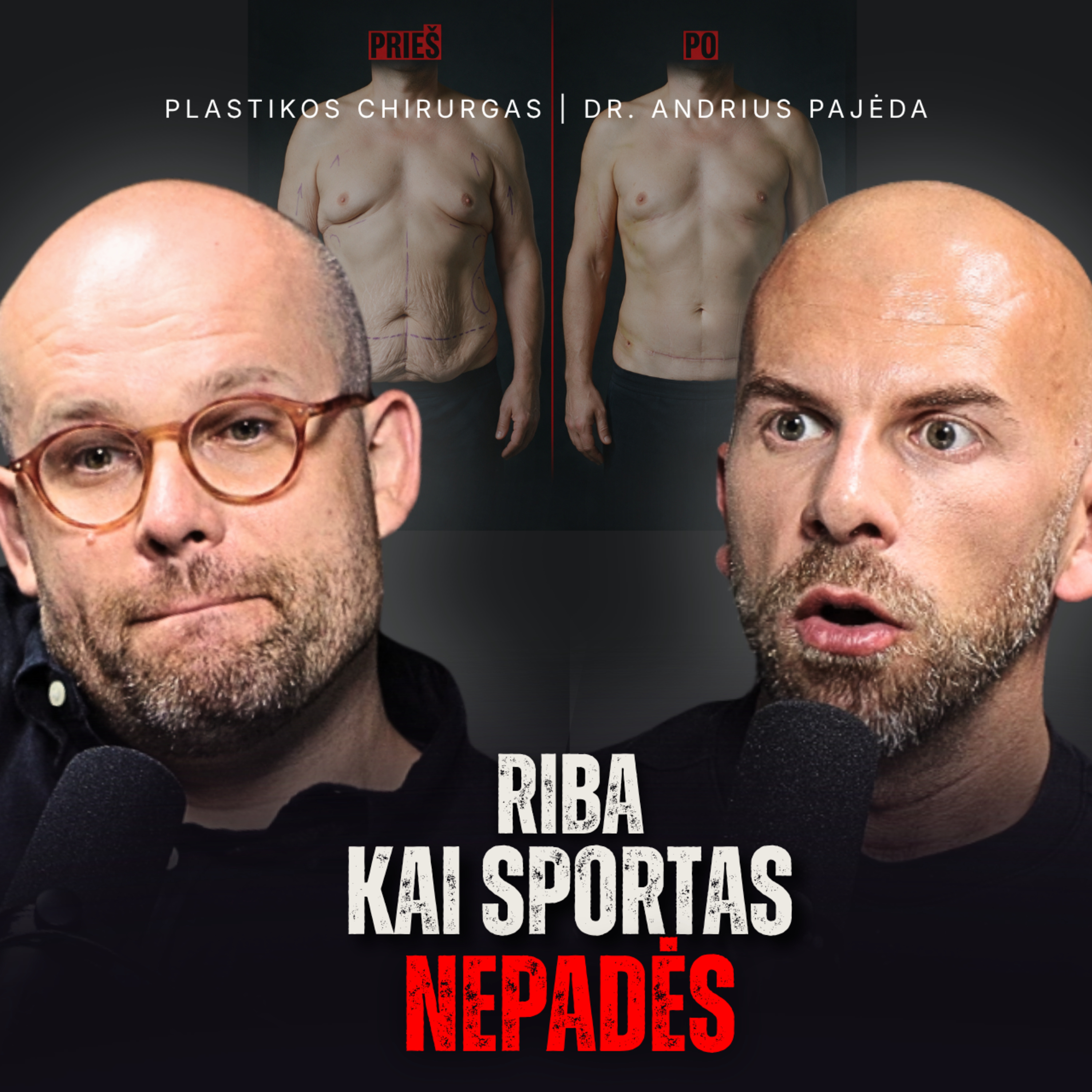 PLASTIKOS CHIRURGAS: po Ozempic oda NUKARO tiek - žmogus NUSTOJO girdėti episode artwork