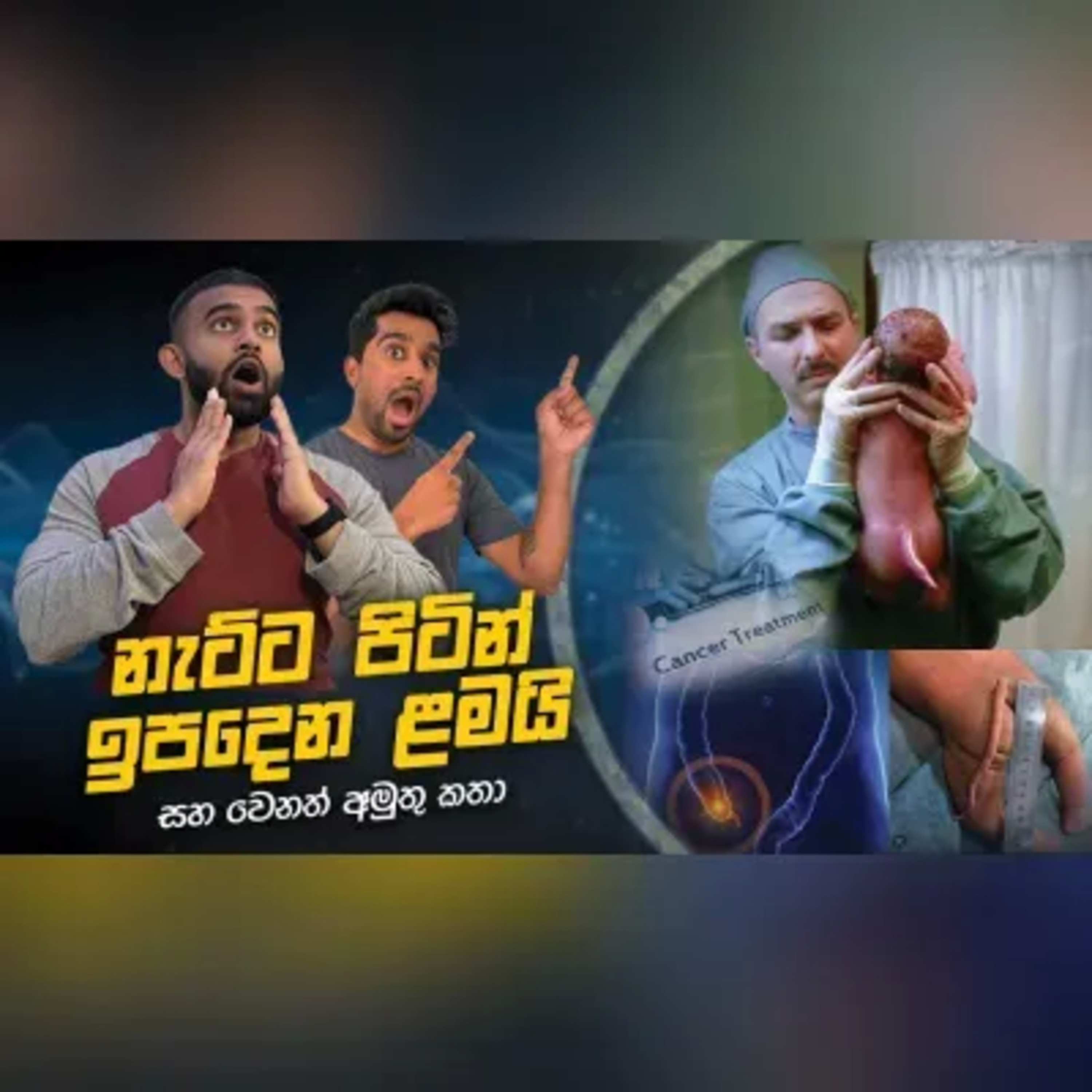 අවශිෂ්ට අවයව කියන්නේ මොනාද? සහ තවත් අමුතු කතා Buntcast EP 12