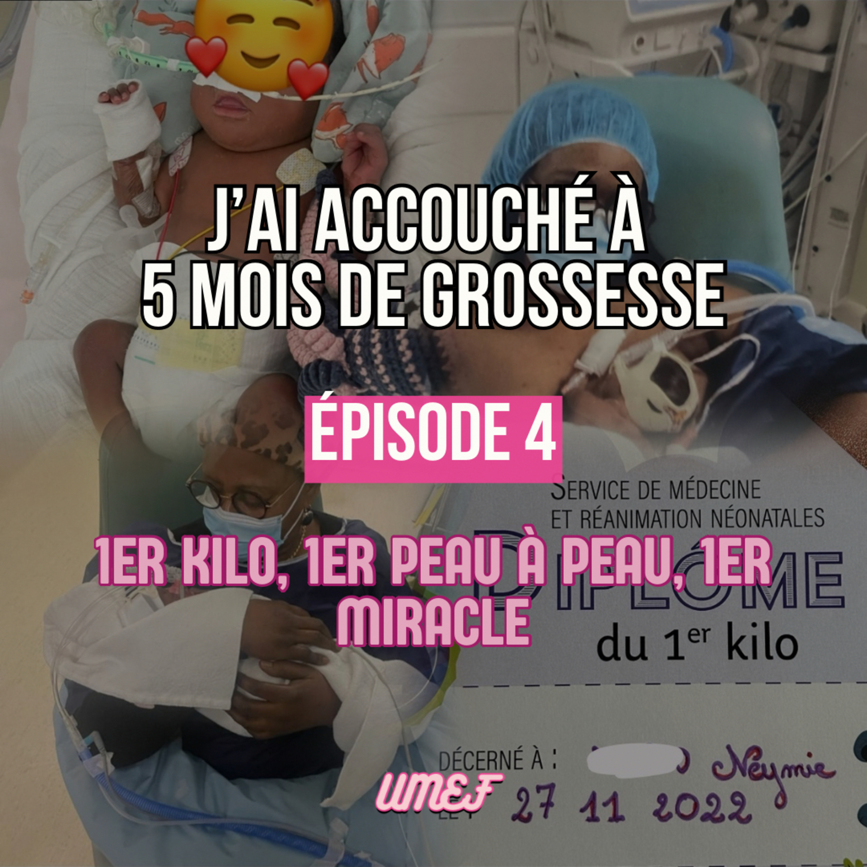 J’ai accouché à 5 mois de grossesse Partie 4 : 1er kilo, 1er peau à peau, décès, miracle episode artwork