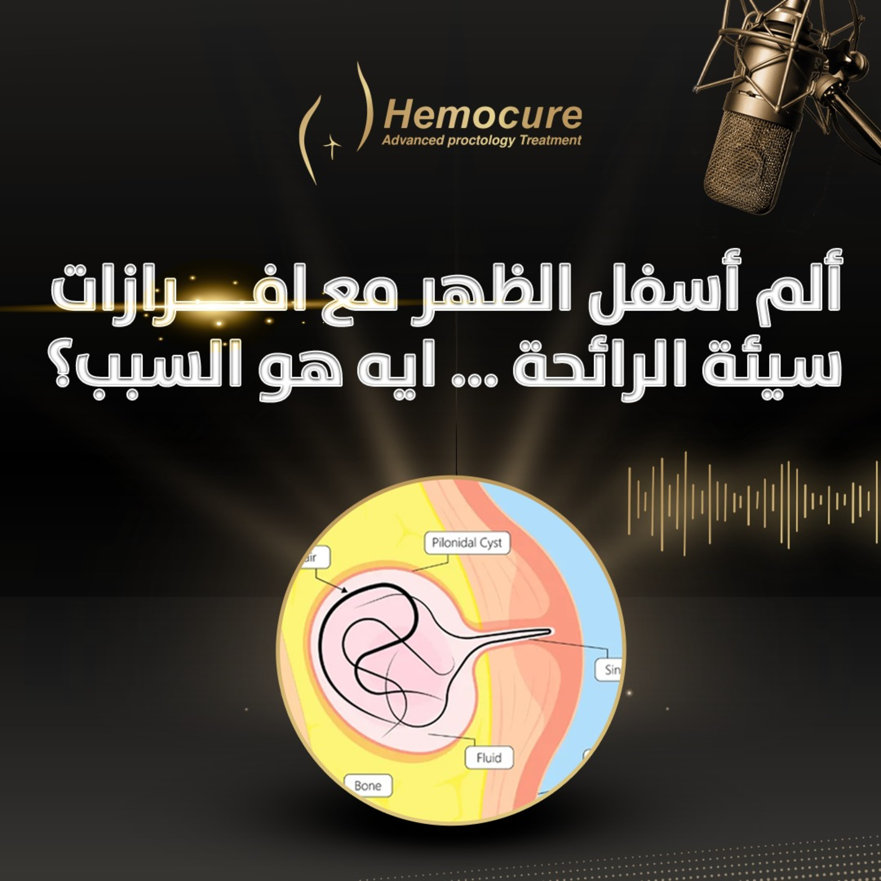 ألم أسفل الضهر مع افرازات سيئة الرائحة ... ايه هو السبب؟  episode artwork