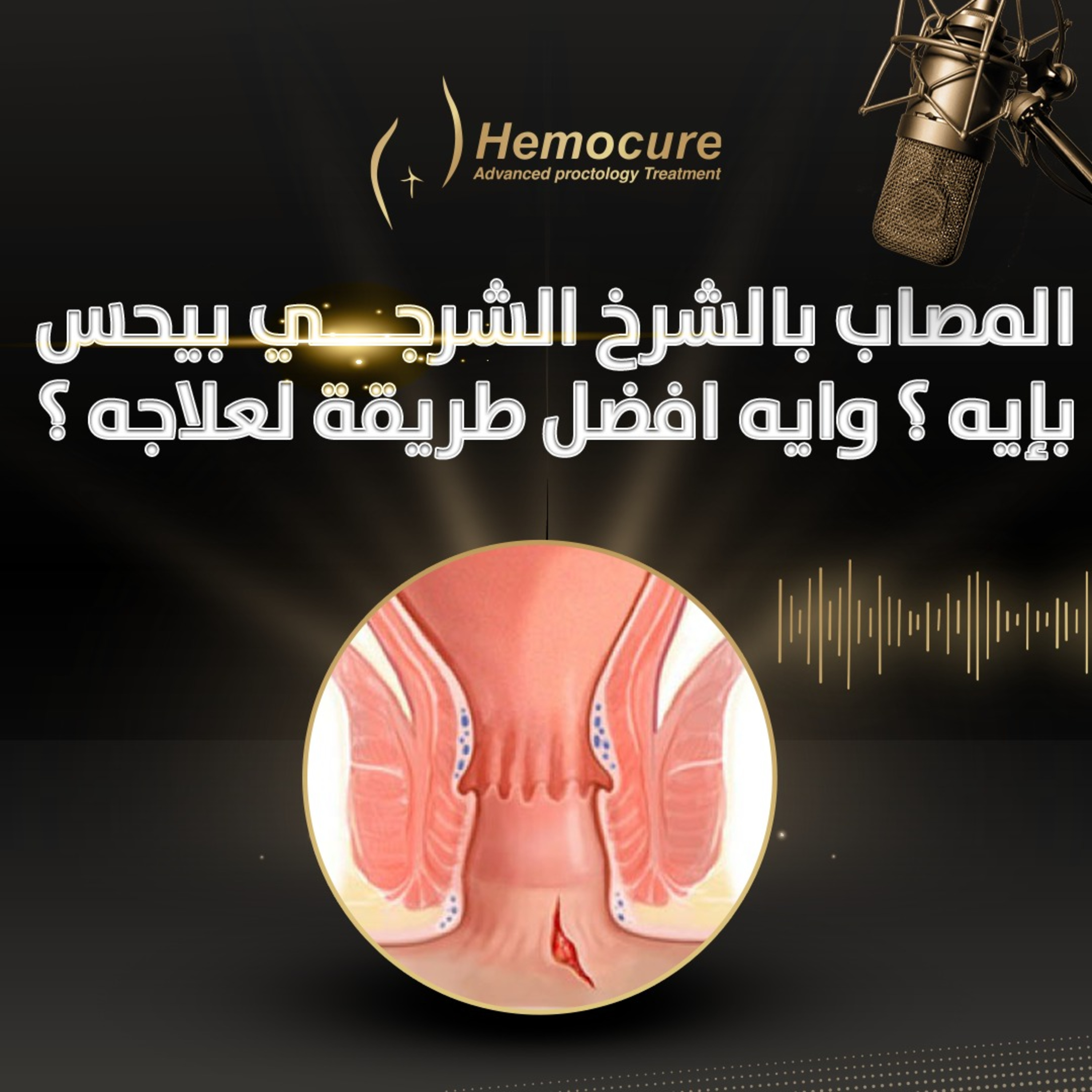 ألم عند التبرز وصعوبة في انجاز المهام اليومية البسيطة ... دي أعراض ايه؟  episode artwork