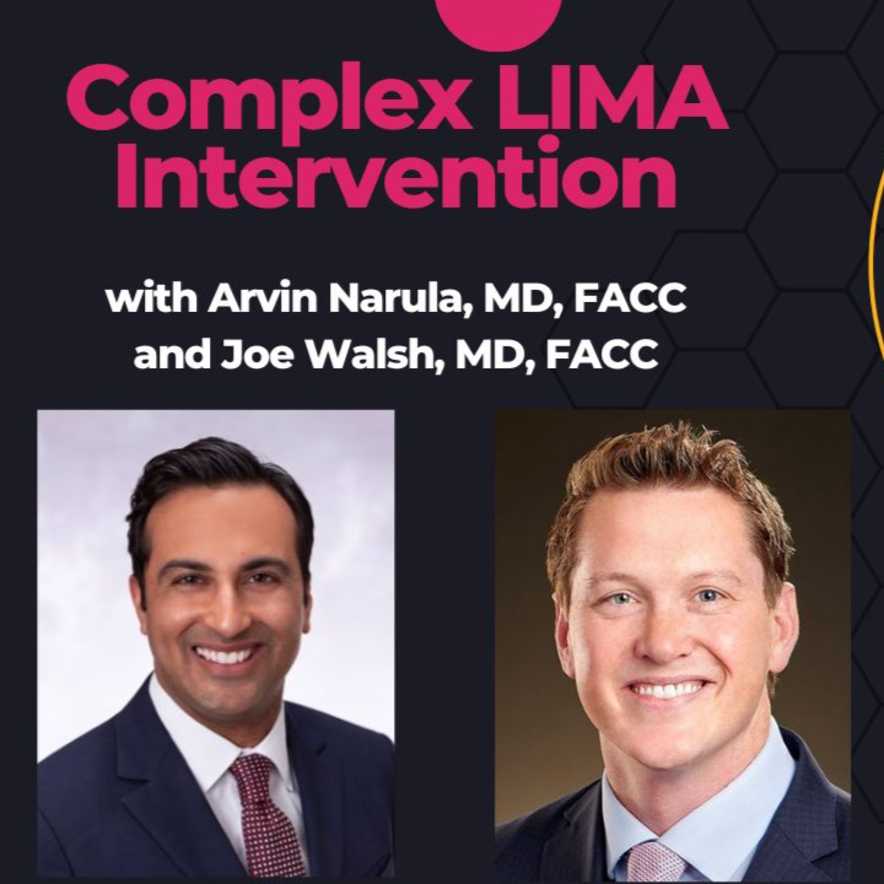 Fixing a Calcified LIMA: Rota, Shockwave, and DCB in a Tortuous Distal LAD with Dr. Arvin Narula and Dr. Joe Walsh Fixing a Calcified LIMA: Rota, Shockwave, and DCB in a Tortuous Distal LAD with Dr. Arvin Narula and Dr. Joe Walsh