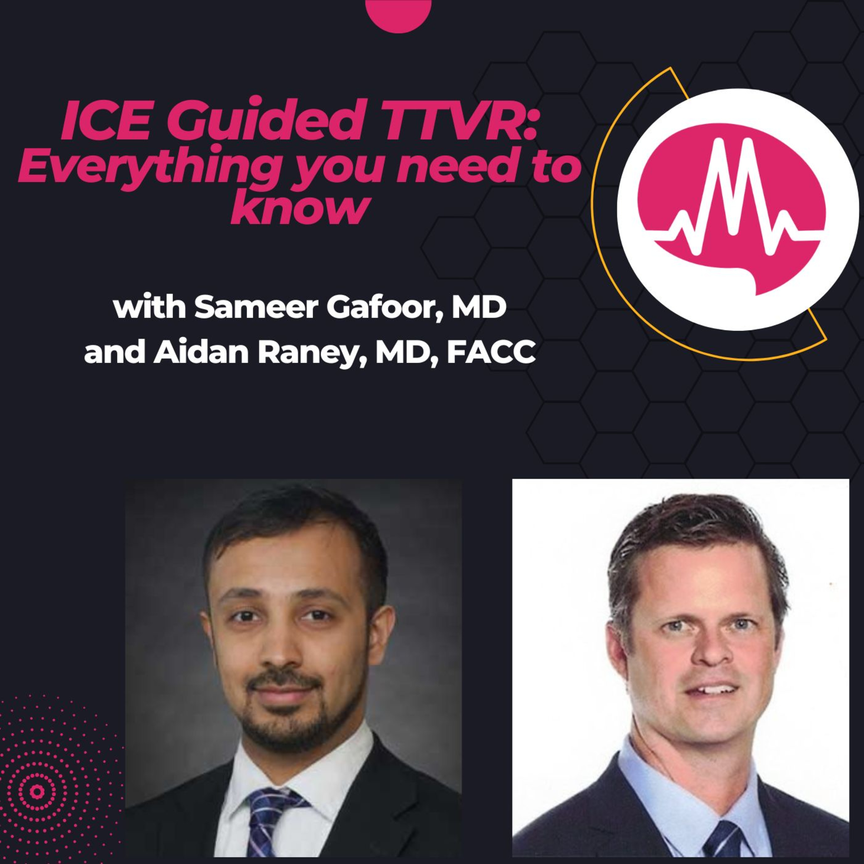 Everything You Need to Know About ICE Guided TTVR with Dr. Sameer Gafoor
