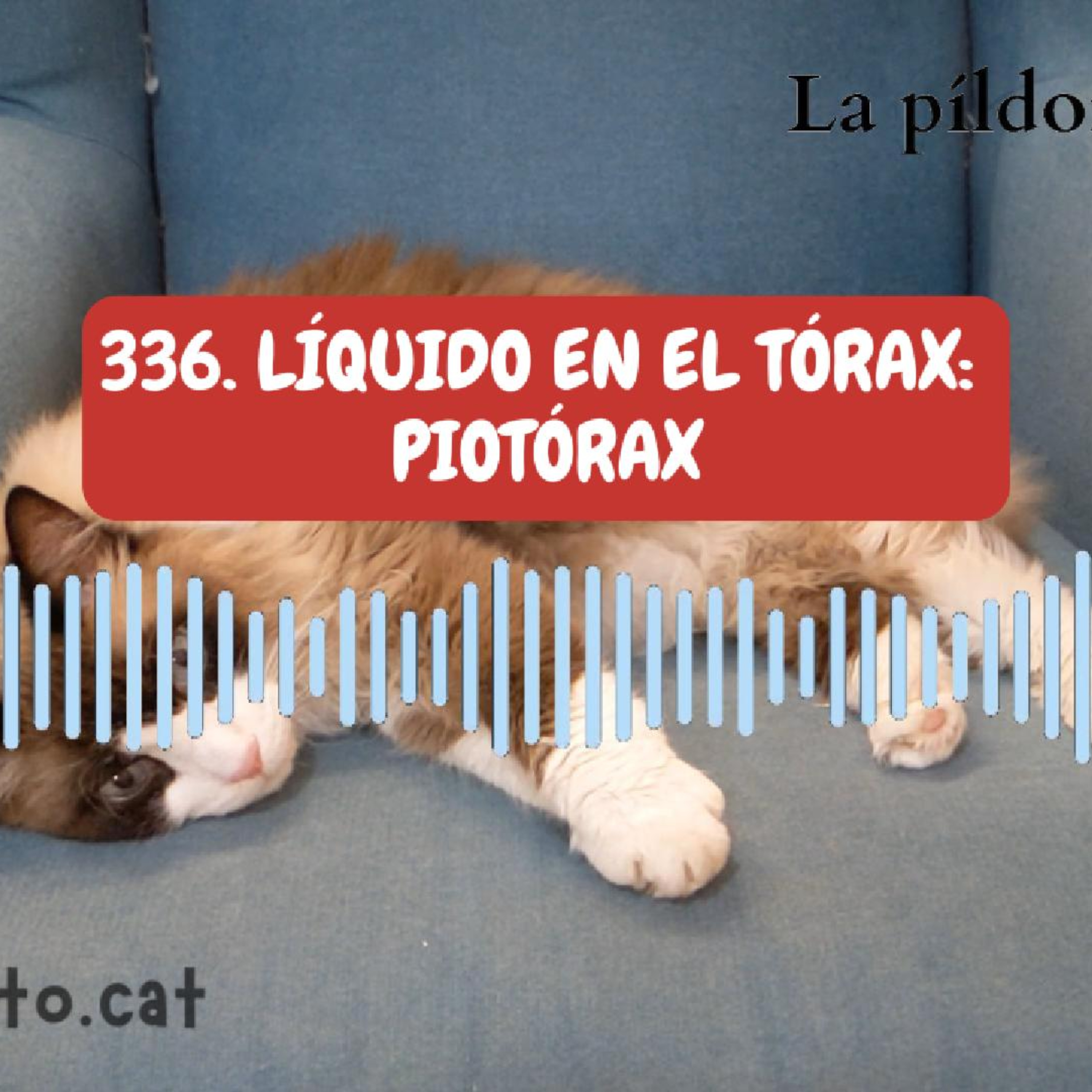 Imagen del episodio 336. Líquido en el tórax: piotórax