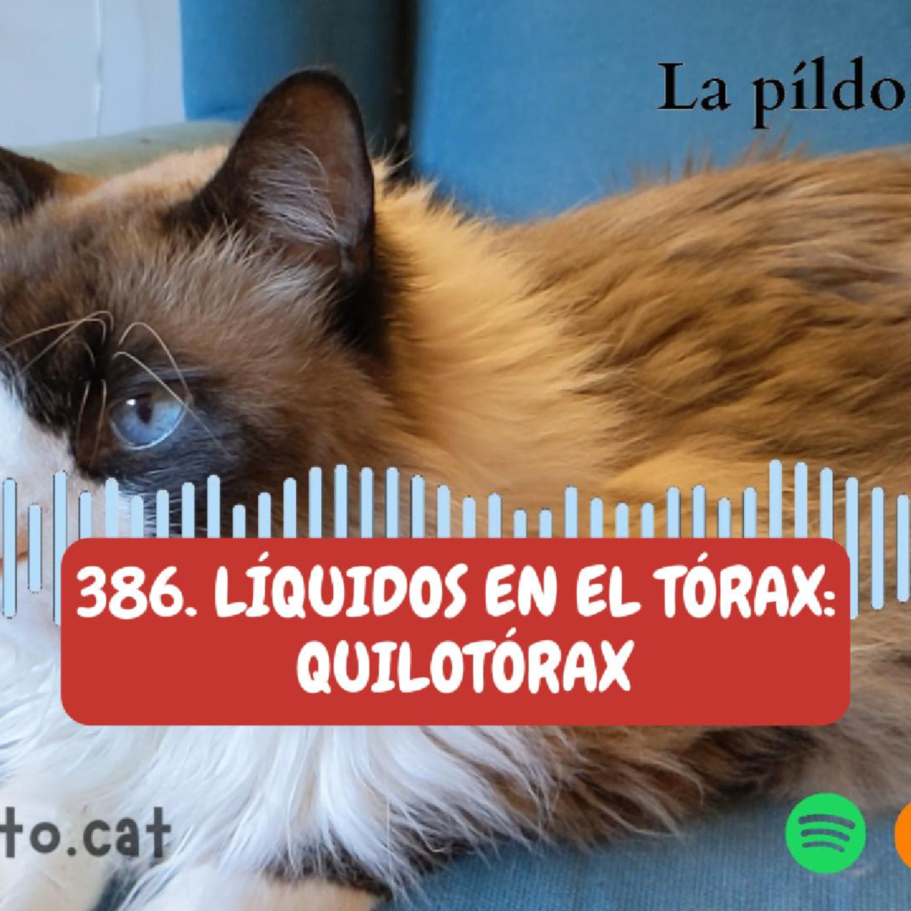 Imagen del episodio 386. Líquidos en el tórax: quilotórax