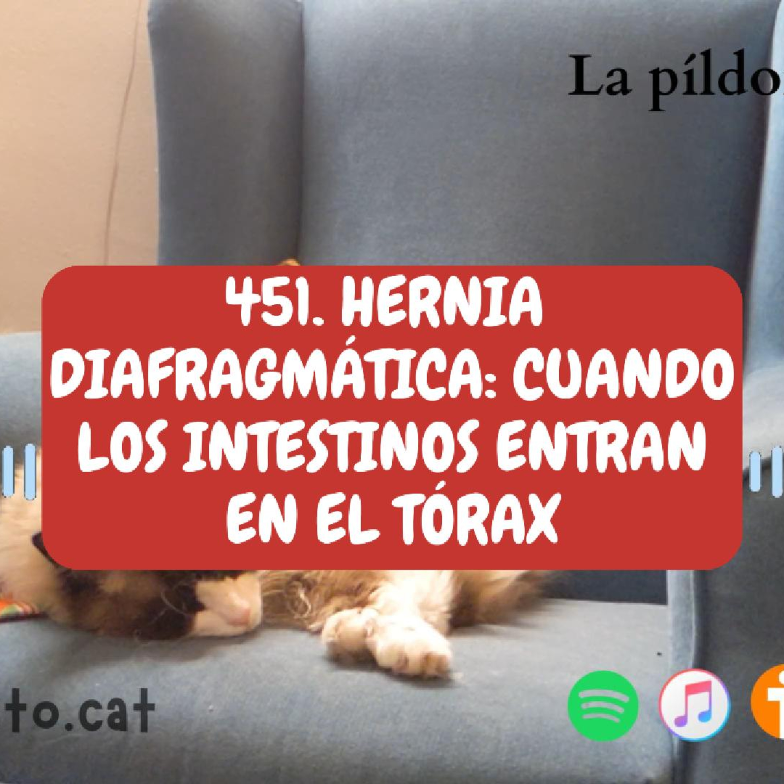 Imagen del episodio 451. HERNIA DIAFRAGMÁTICA: cuando los intestinos entran en el tórax