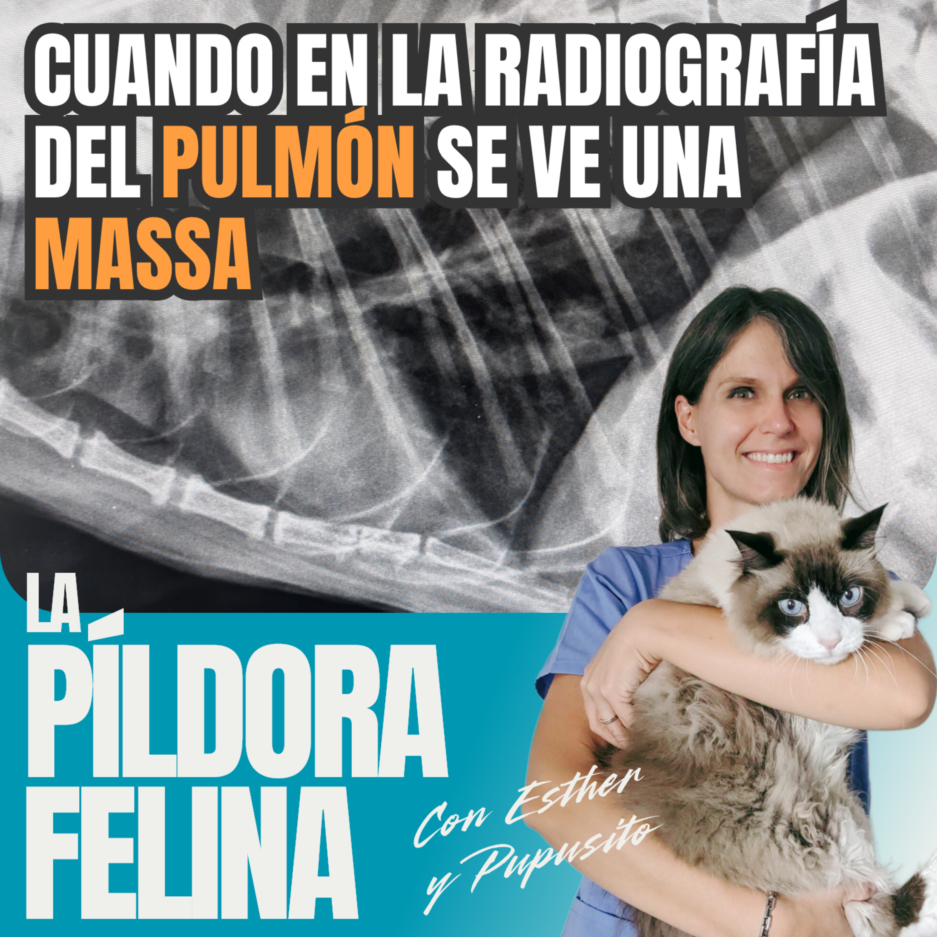 Imagen del episodio 686. Cuando en la radiografía del PULMÓN se ve una MASSA