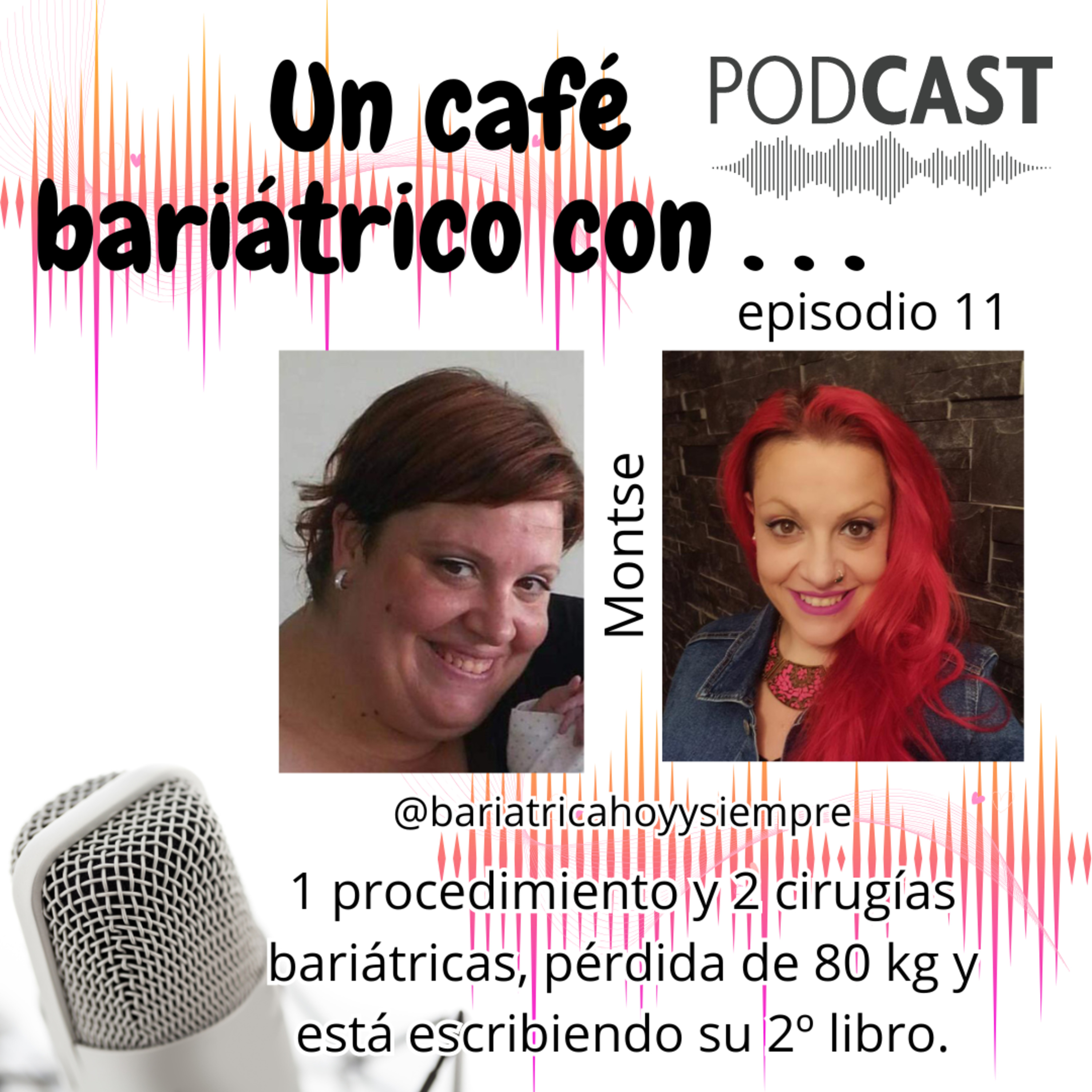 Un café bariátrico con . . .