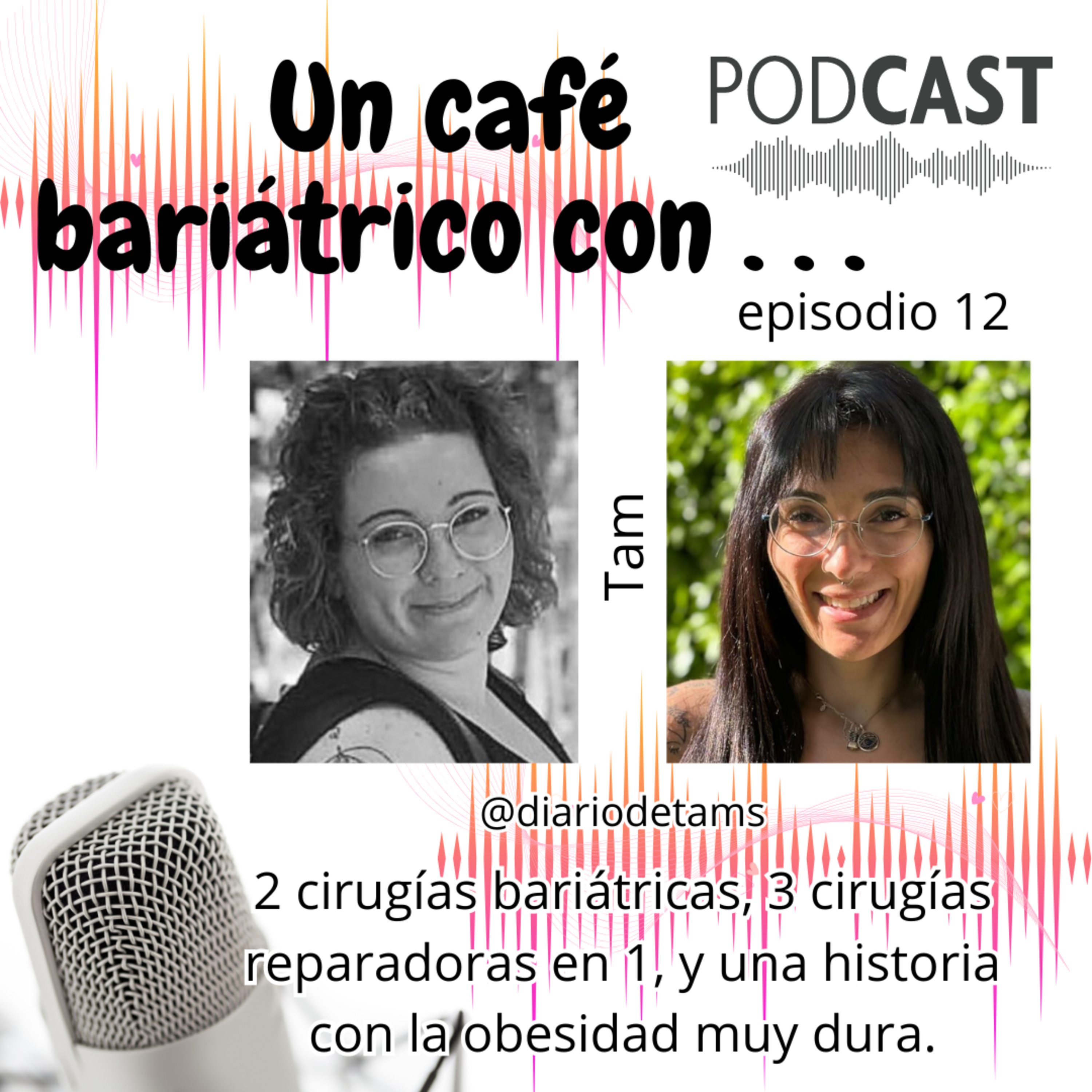 Un café bariátrico con . . .