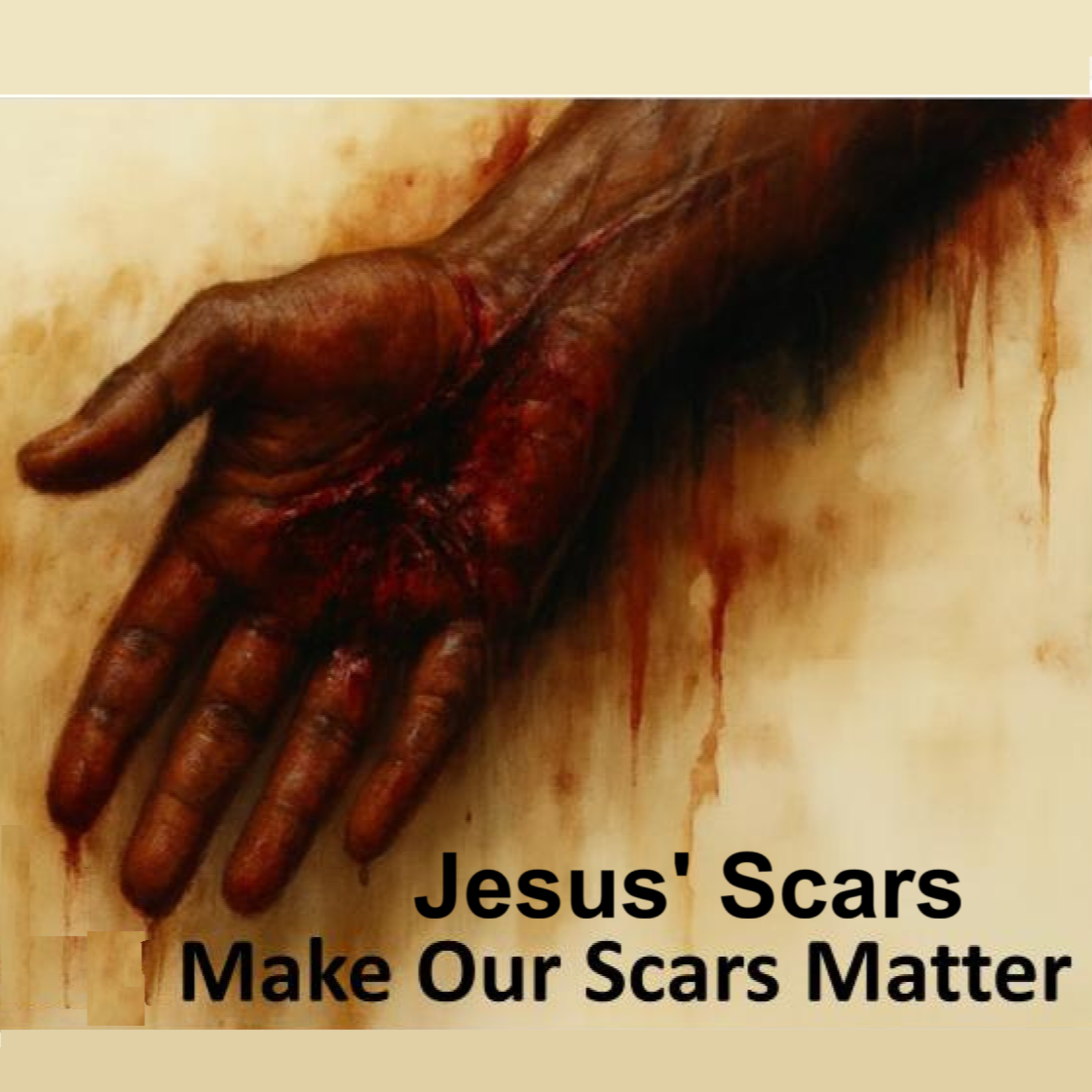 Jesus’ Scars Make Our Scars Matter - Minister George Ferguson episode artwork
