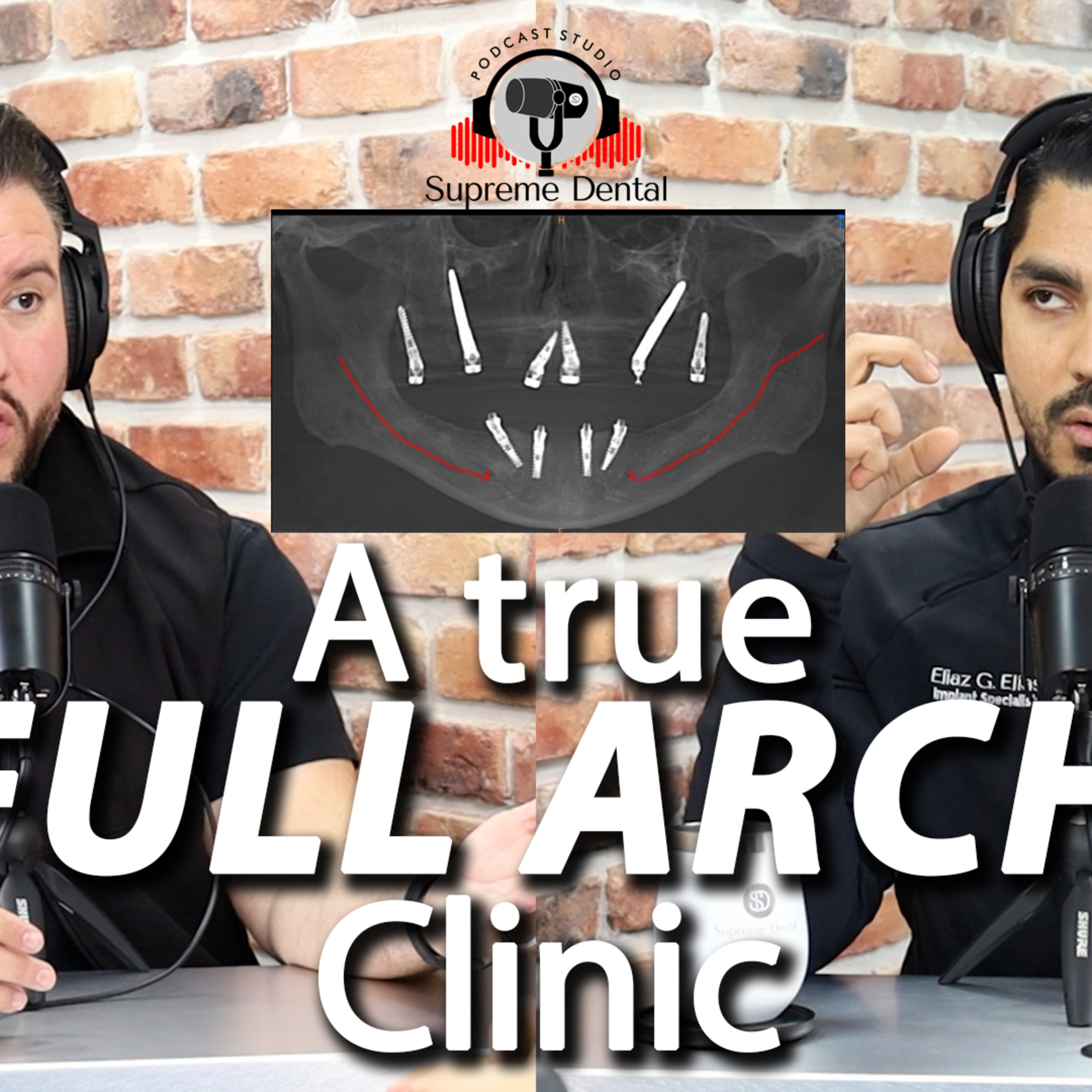 Ep. 76. The Full Arch Solution: Everything you need to know about All-on-X. episode artwork