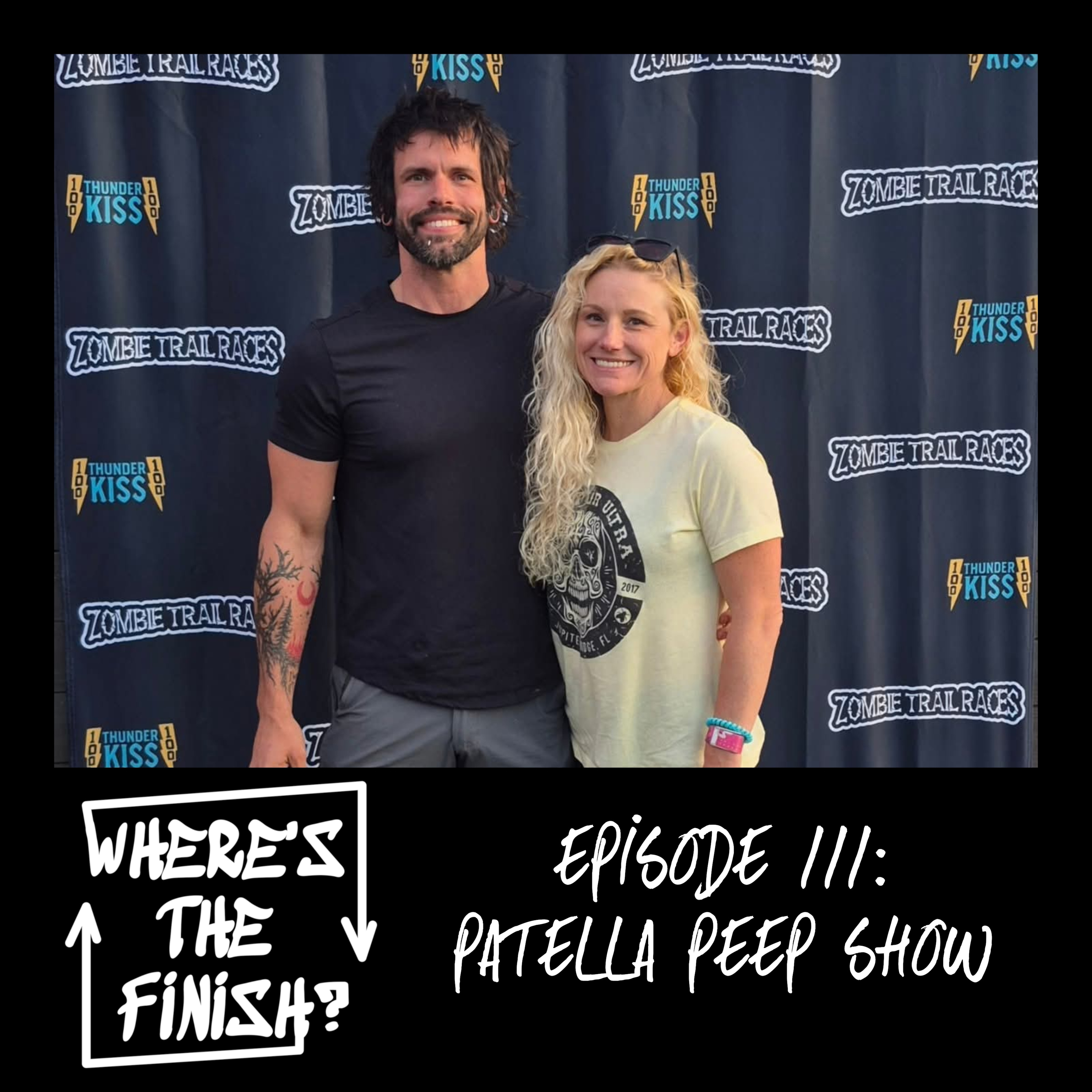 111: Patella Peep Show