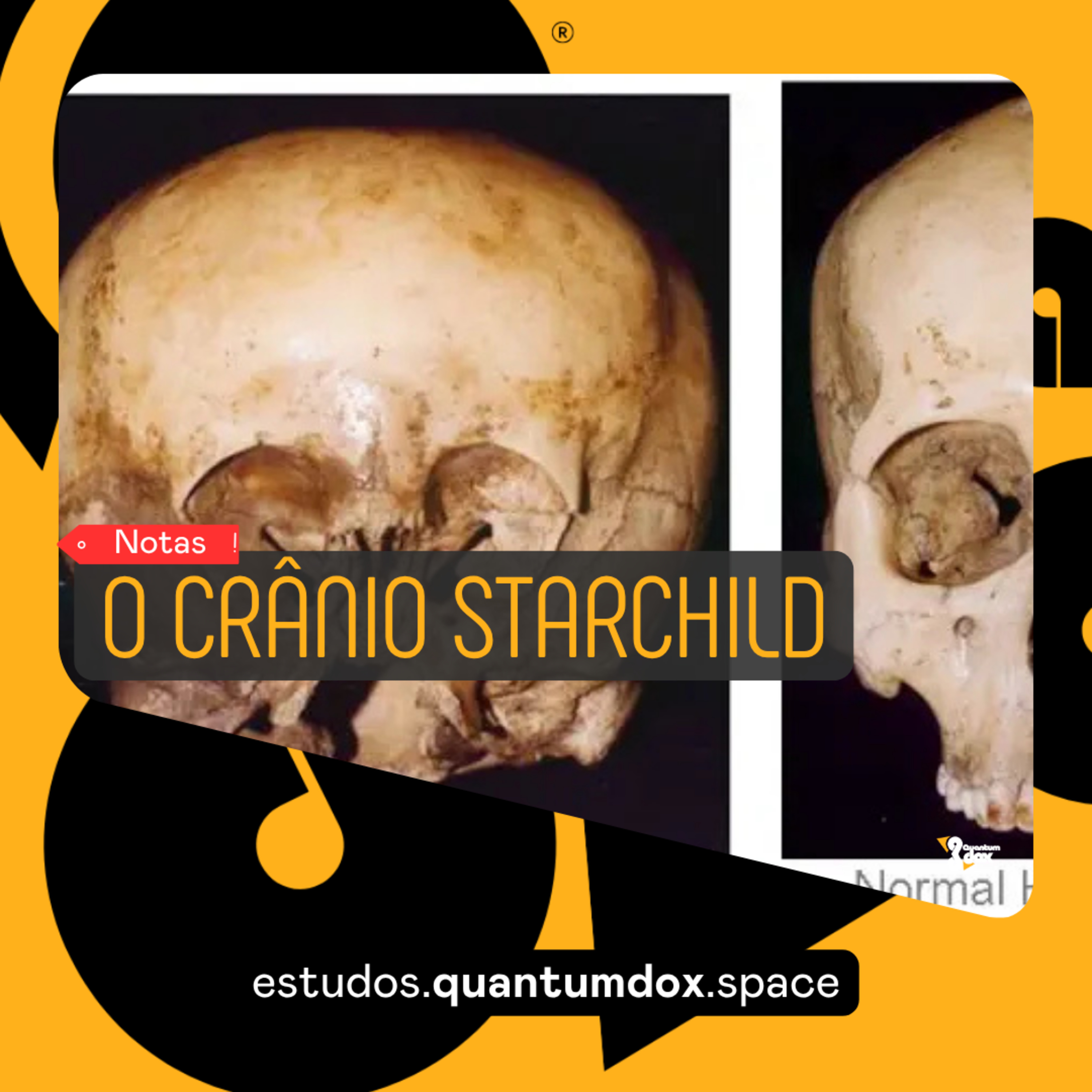 👽 O Enigma do Crânio Starchild episode artwork