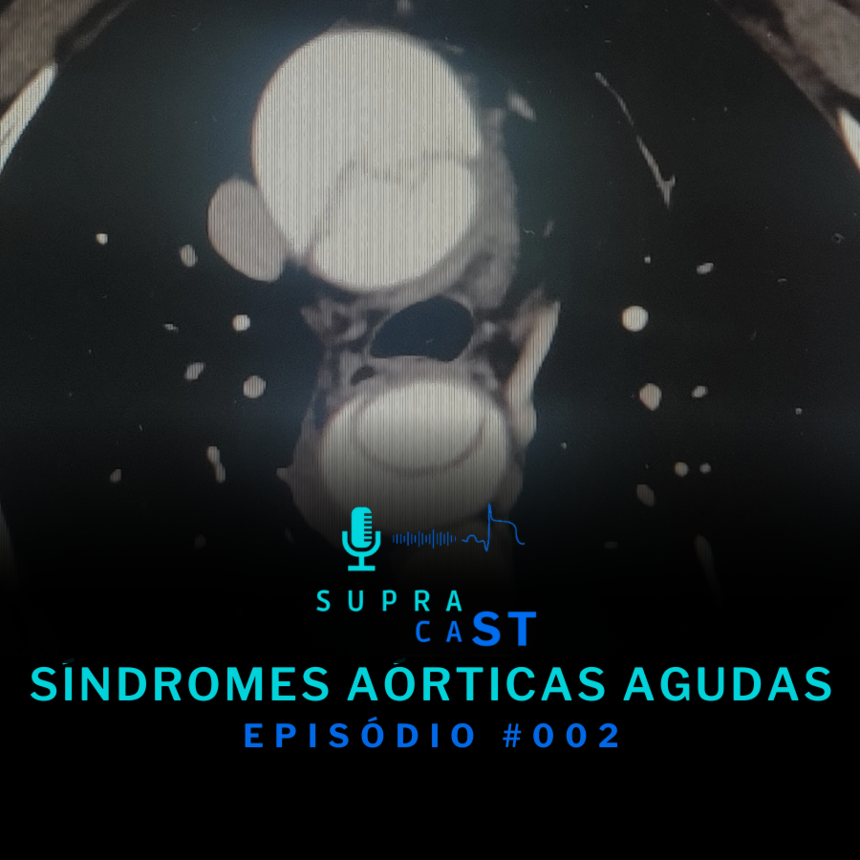 Supra Cast - Cardiologia