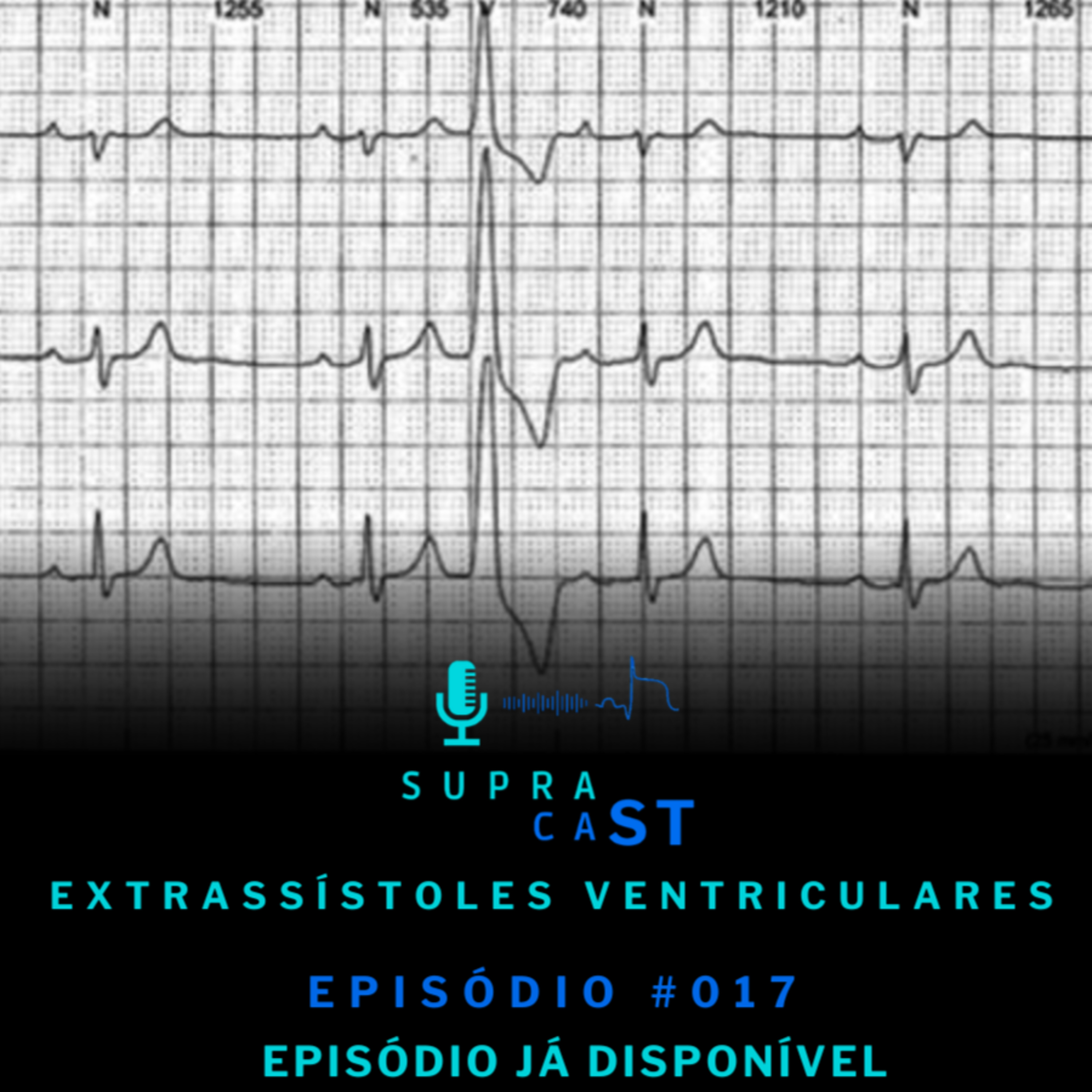 17. Extrassístoles Ventriculares episode artwork