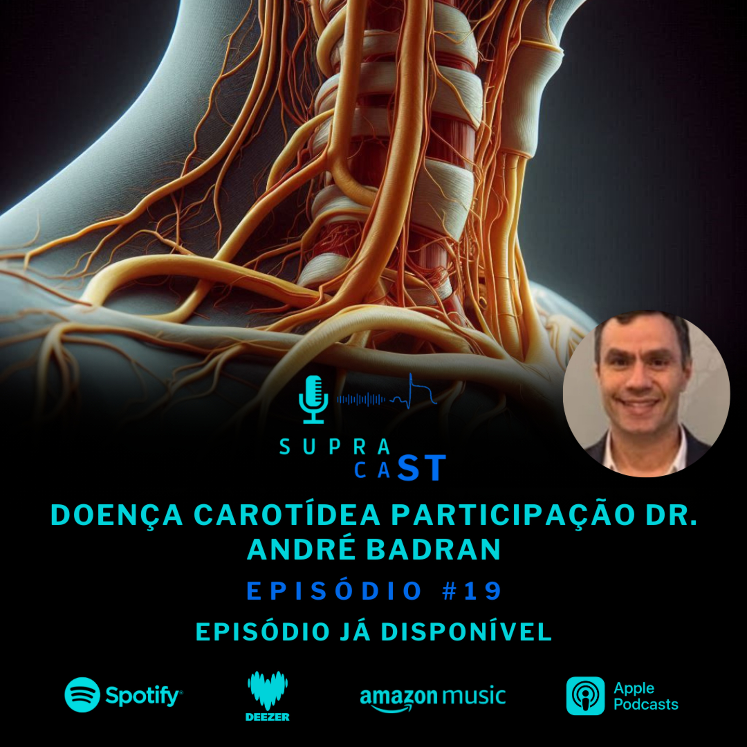 19. Doença Carotídea episode artwork