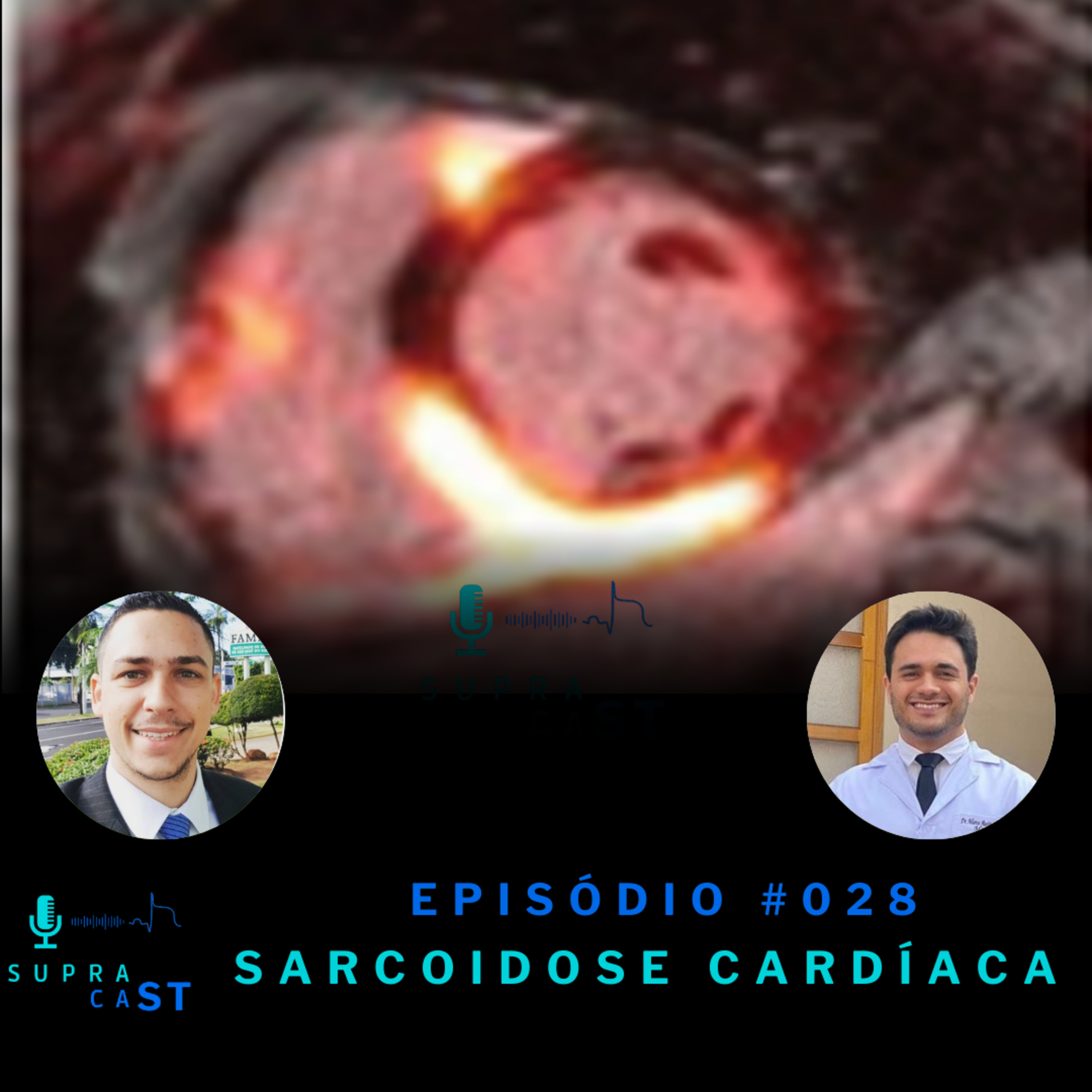 28. Sarcoidose Cardíaca episode artwork