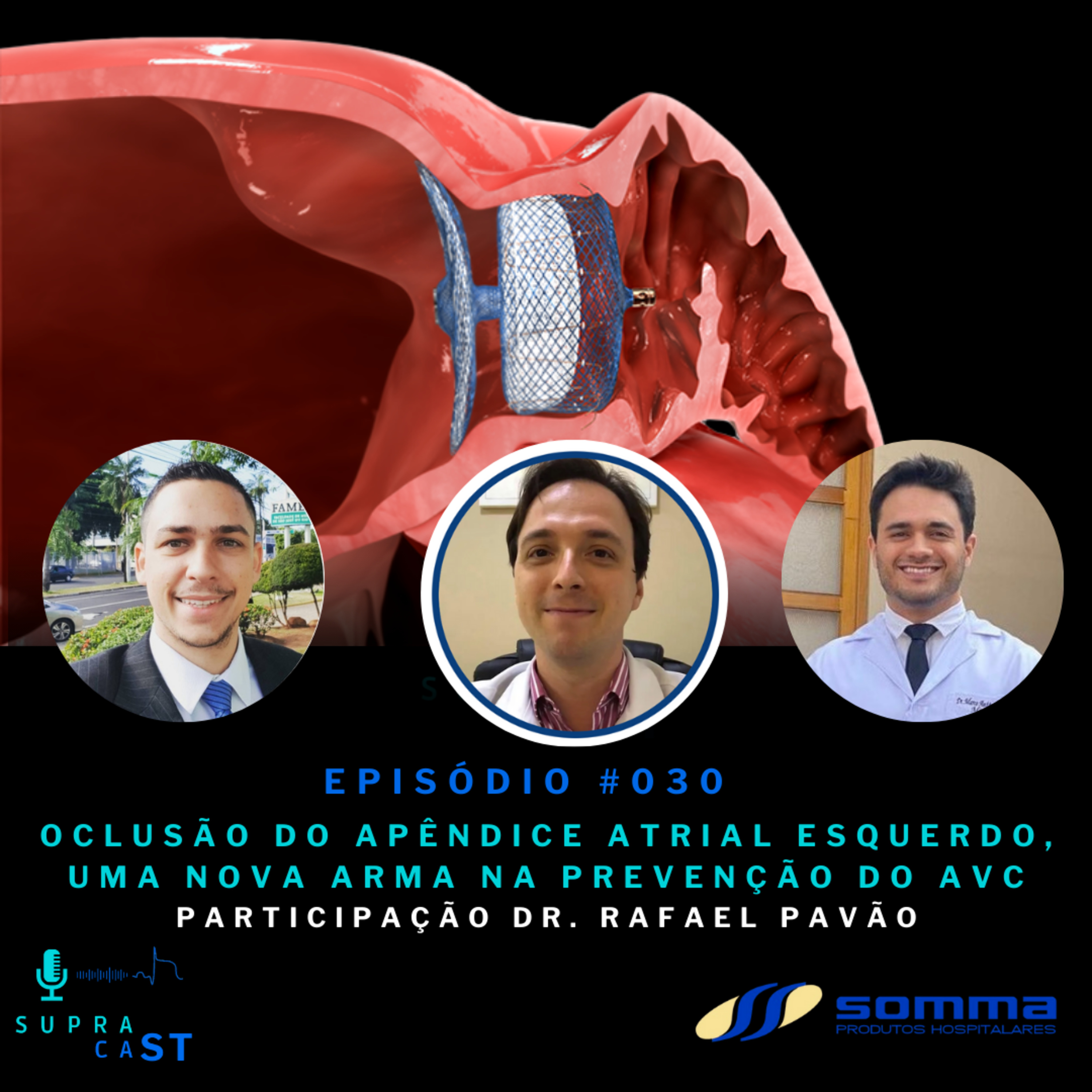 30. Oclusão do Apêndice Atrial Esquerdo, uma nova arma na prevenção do AVC episode artwork
