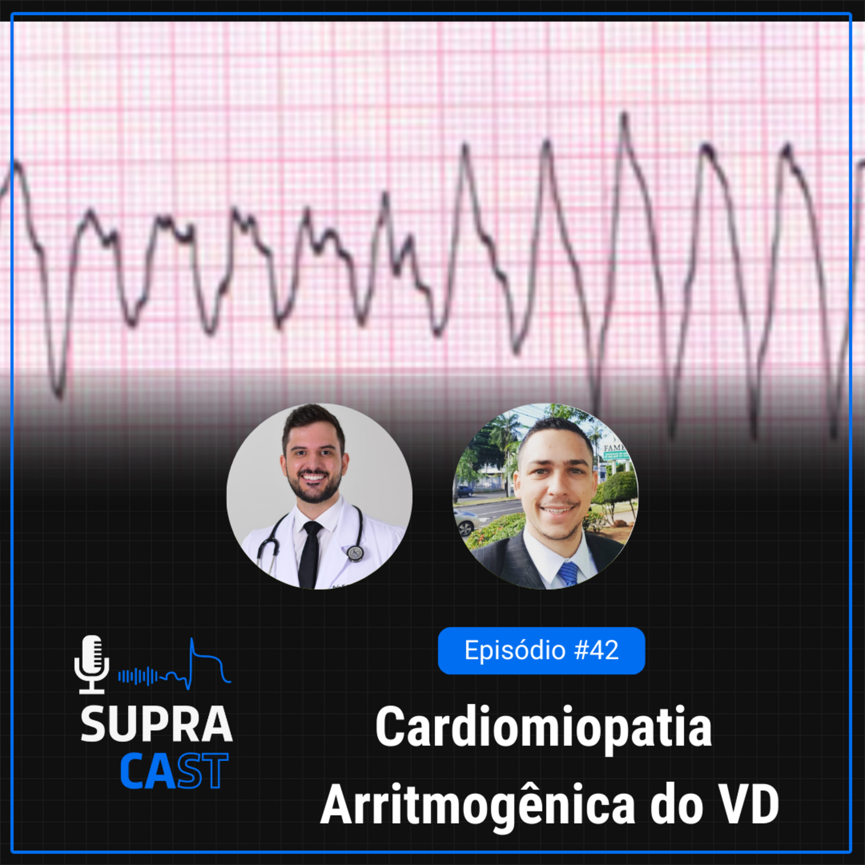 42. Cardiomiopatia Arritmogênica do VD episode artwork