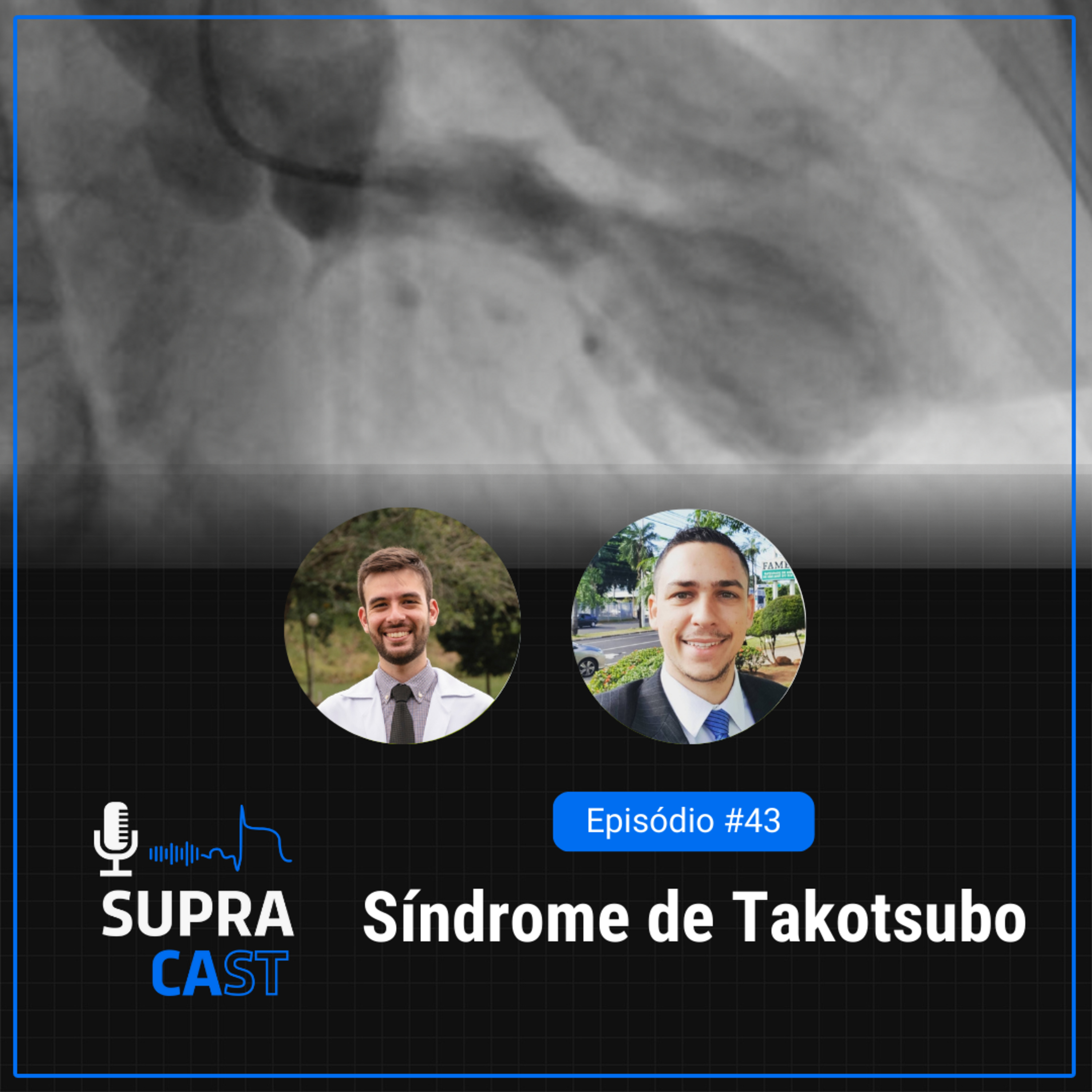 43. Síndrome de Takotsubo episode artwork