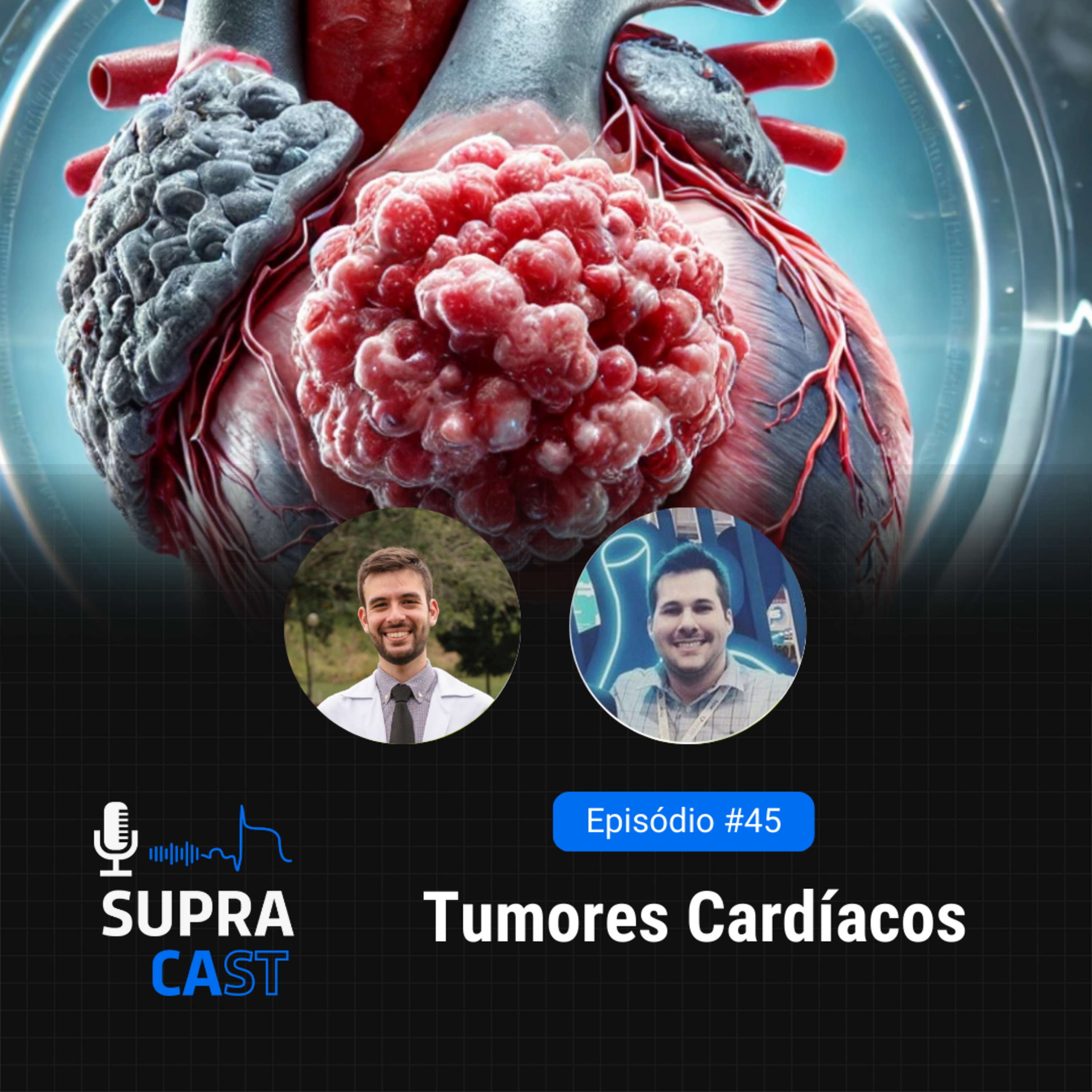 45. Tumores Cardíacos episode artwork