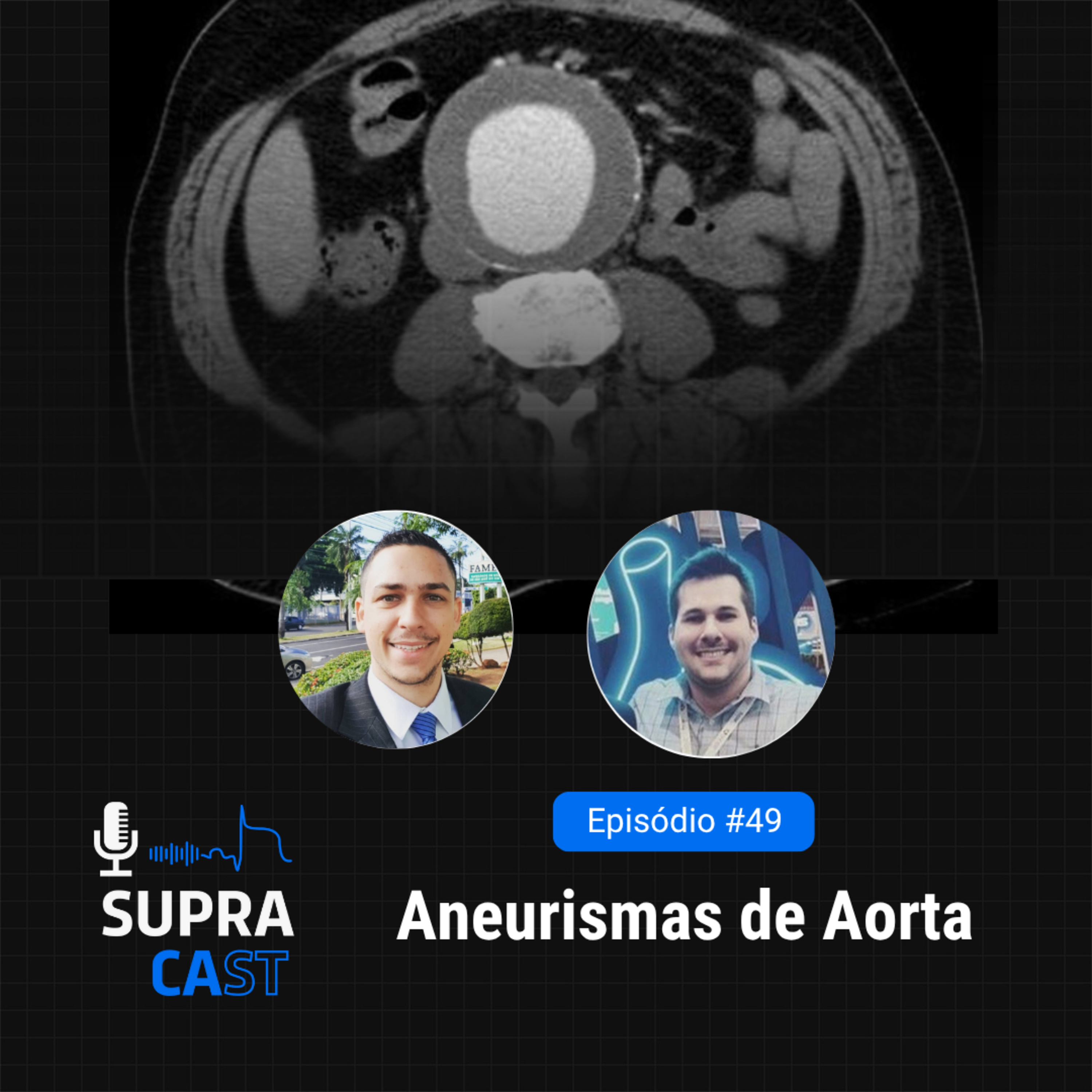 49. Aneurismas de aorta episode artwork