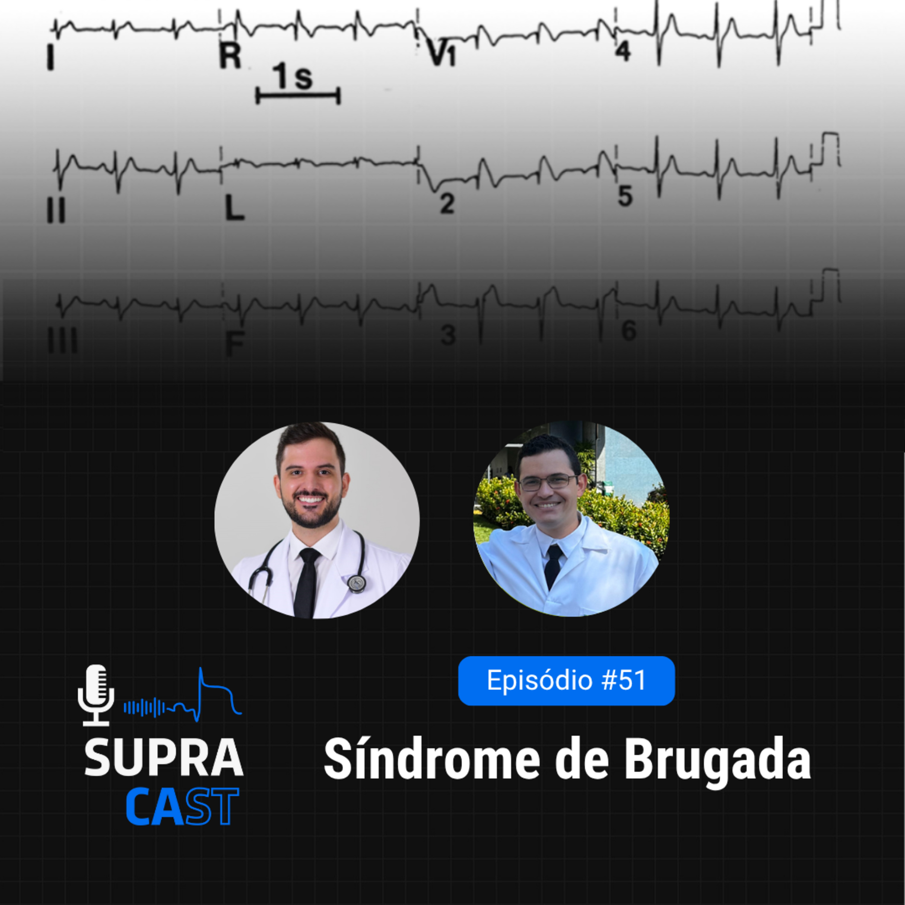 51. Síndrome de Brugada episode artwork