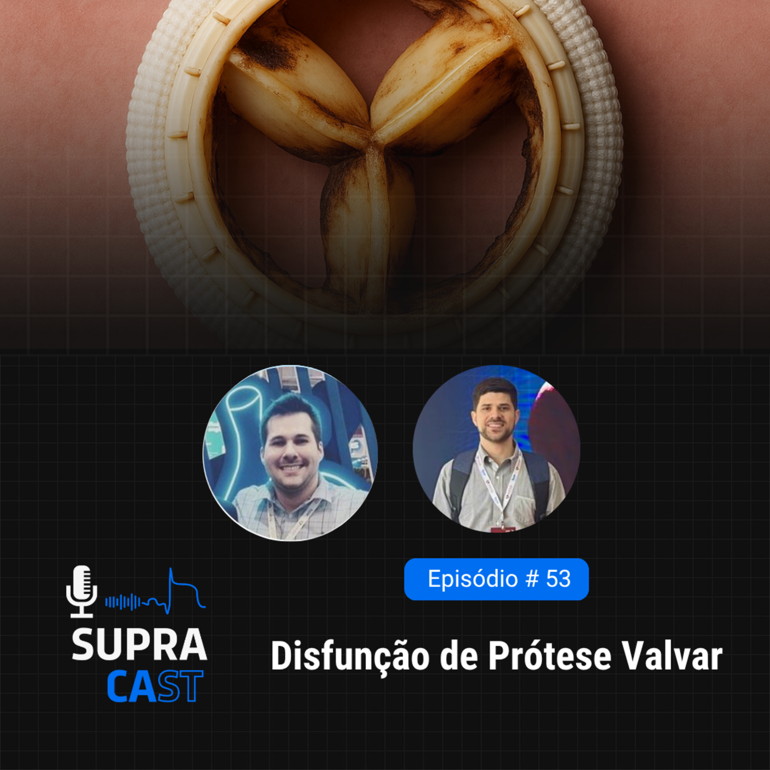 53. Disfunção de prótese valvar episode artwork