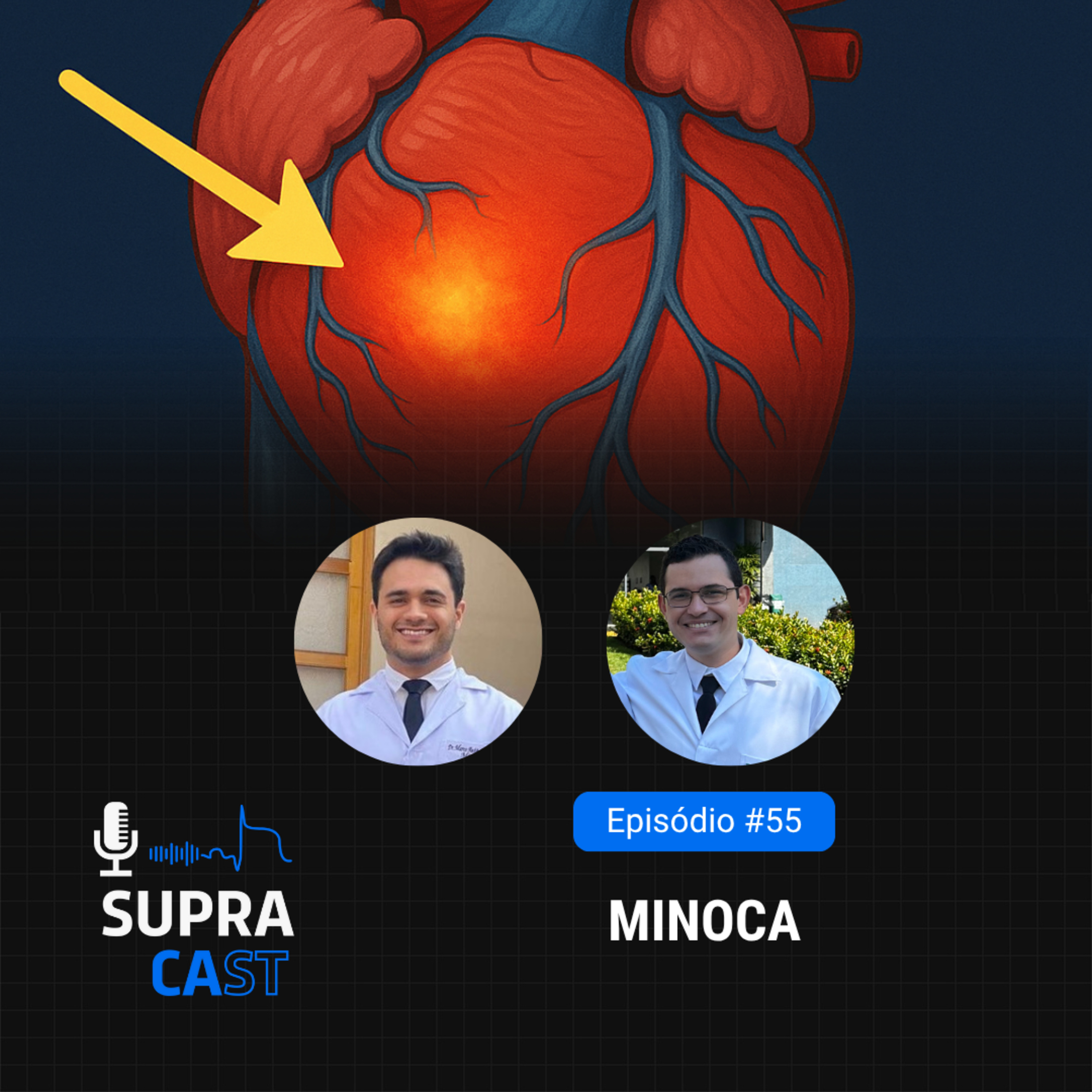 55. Minoca episode artwork