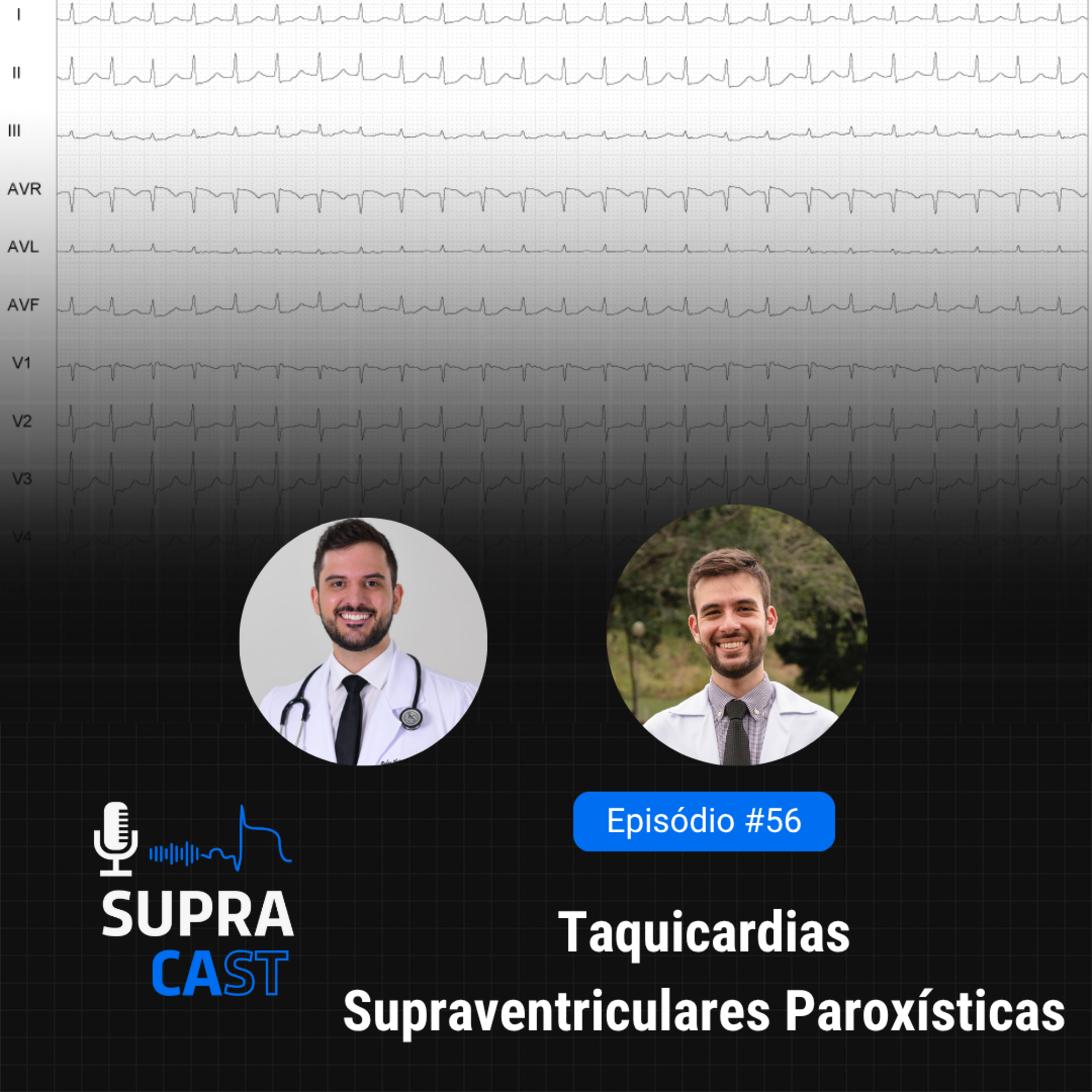 56. Taquicardias Supraventriculares Paroxísticas episode artwork