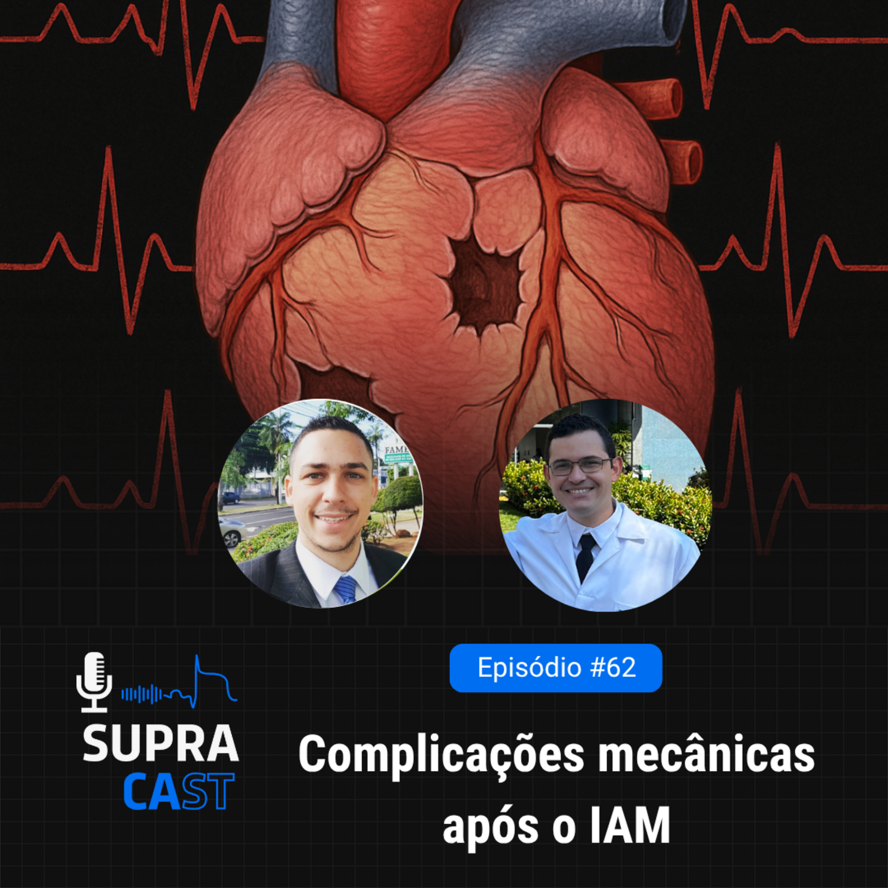 62. Complicações mecânicas após o IAM episode artwork