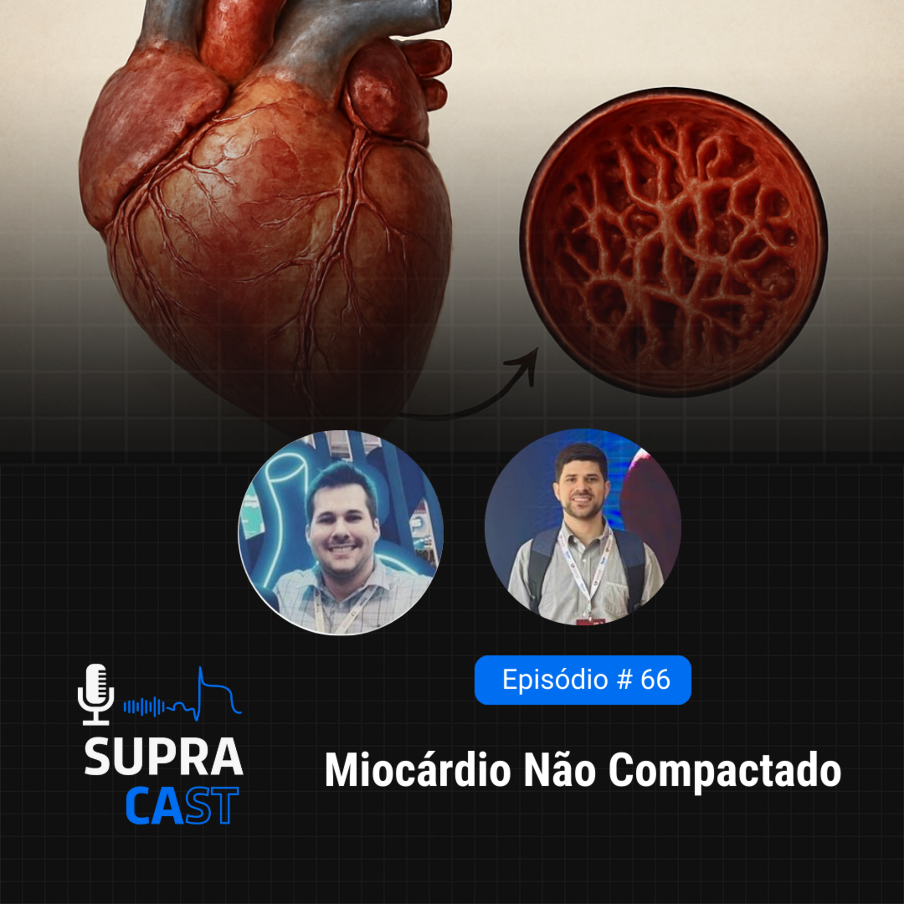 66. Miocárdio não compactado episode artwork