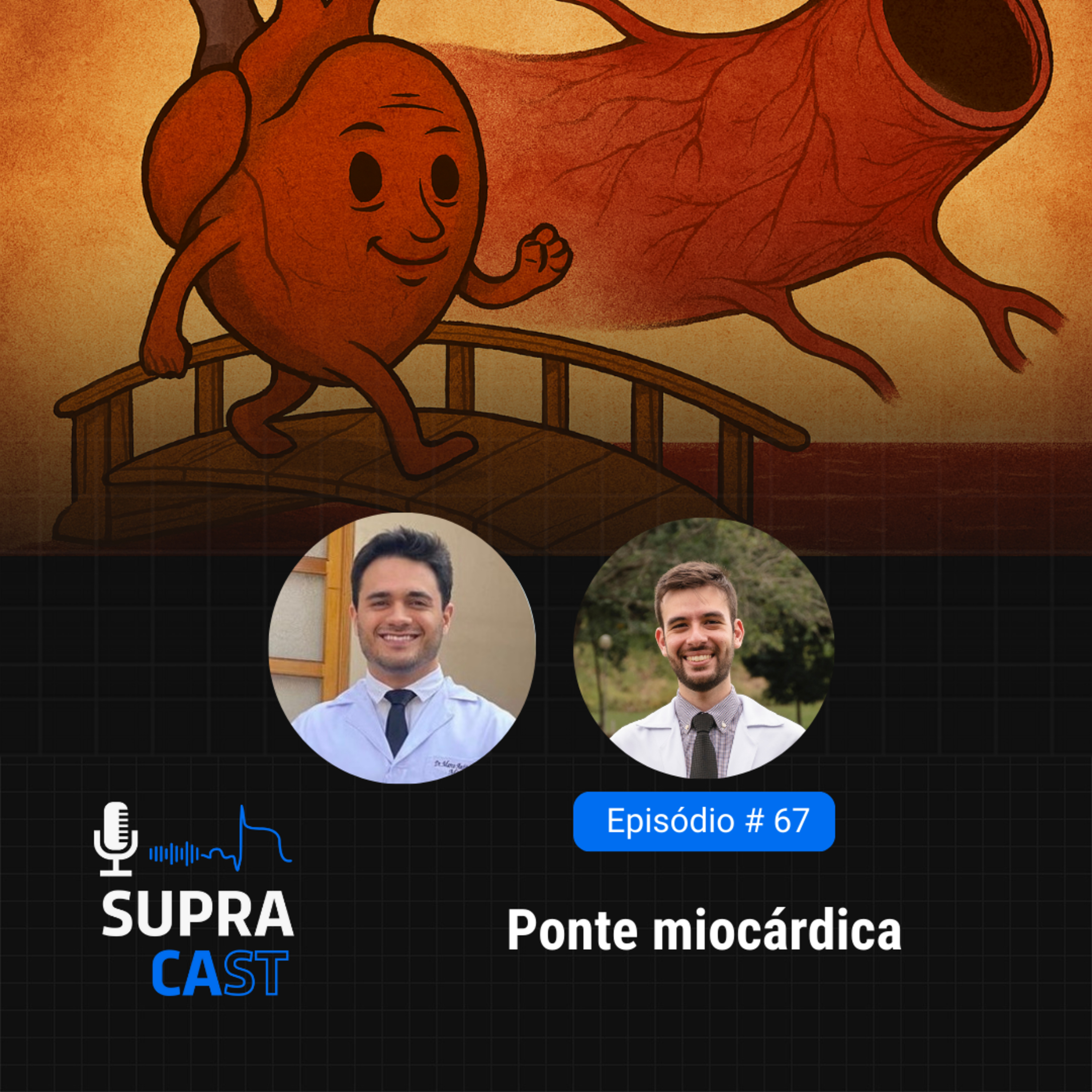67. Ponte miocárdica episode artwork