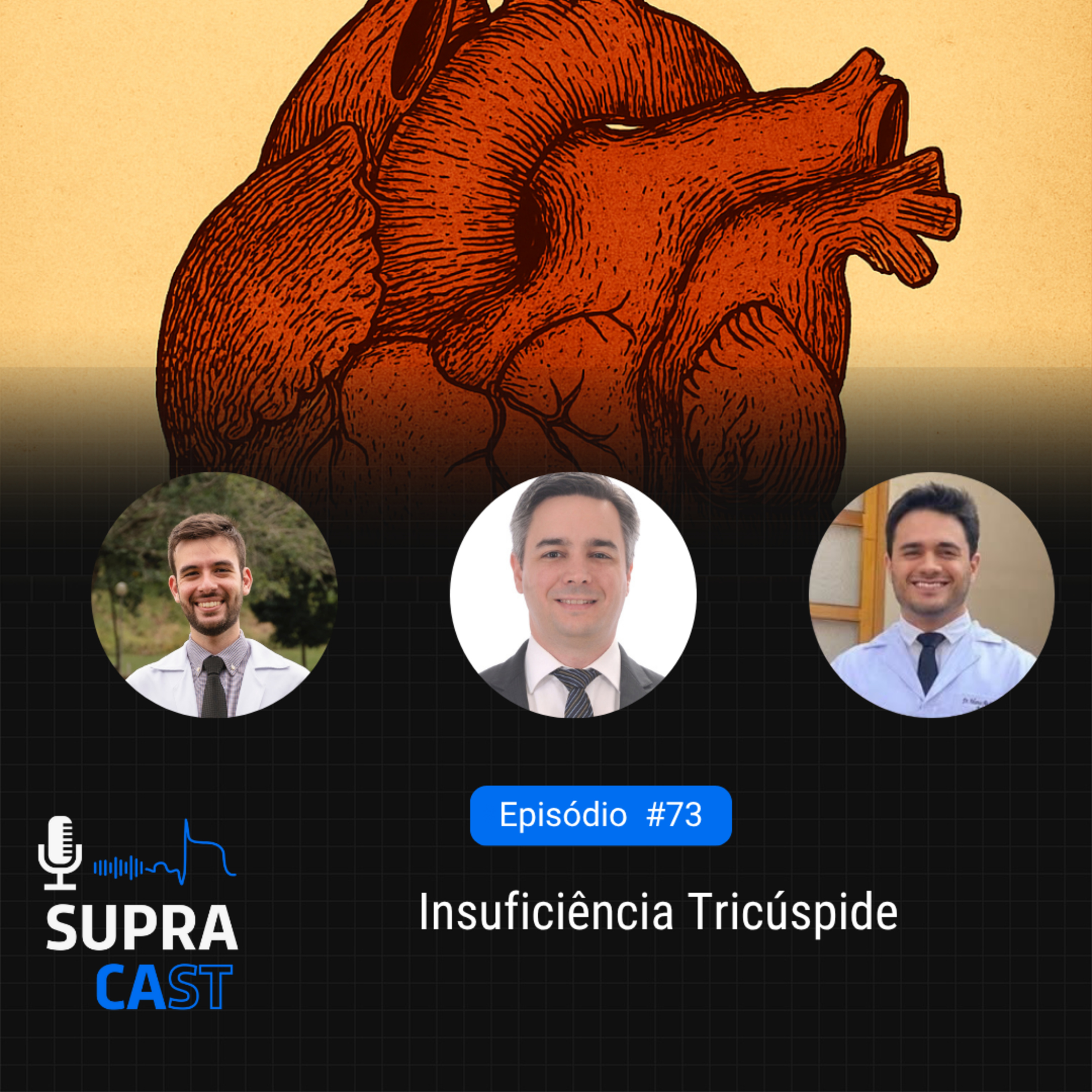 73. Insuficiência tricúspide episode artwork