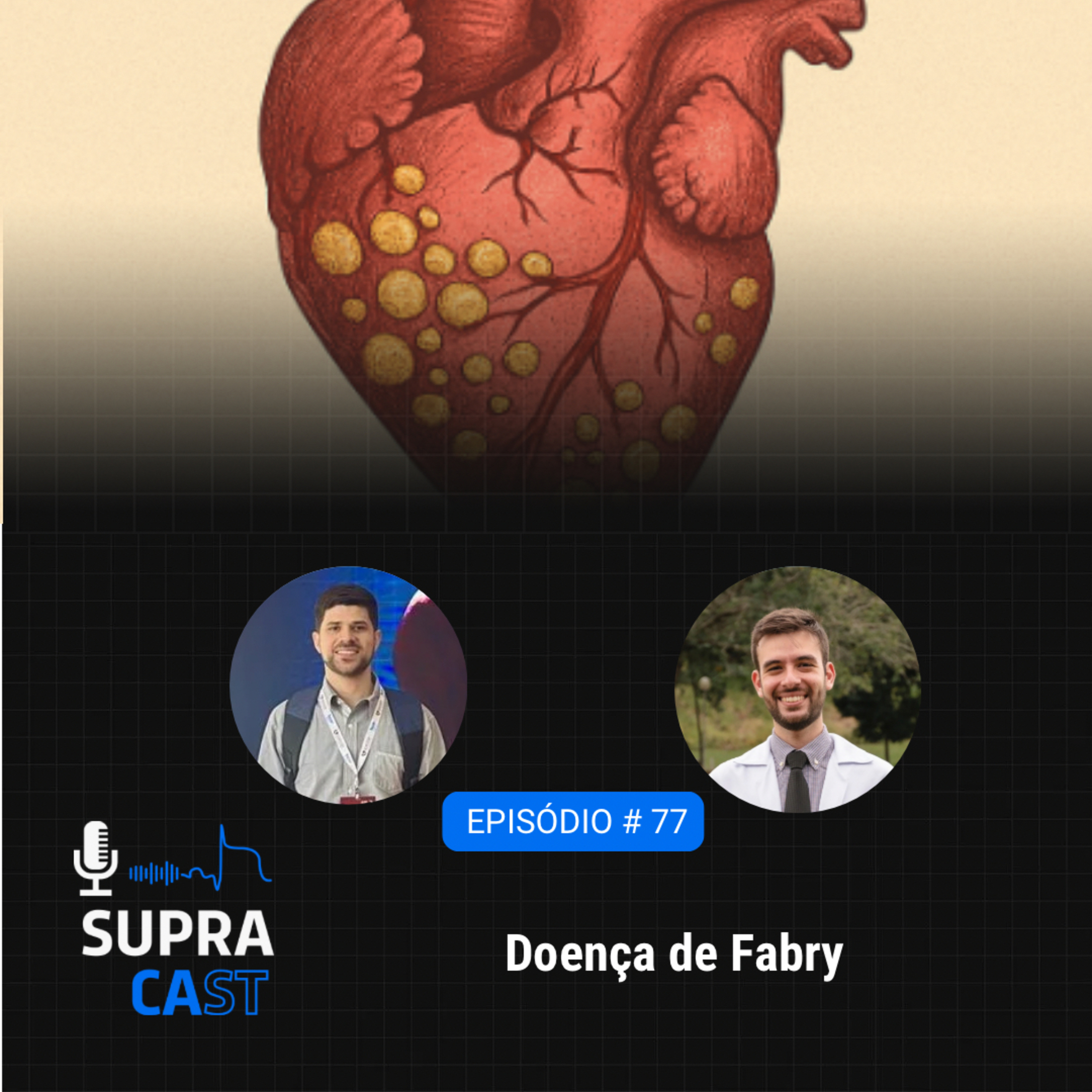 77. Doença de Fabry episode artwork