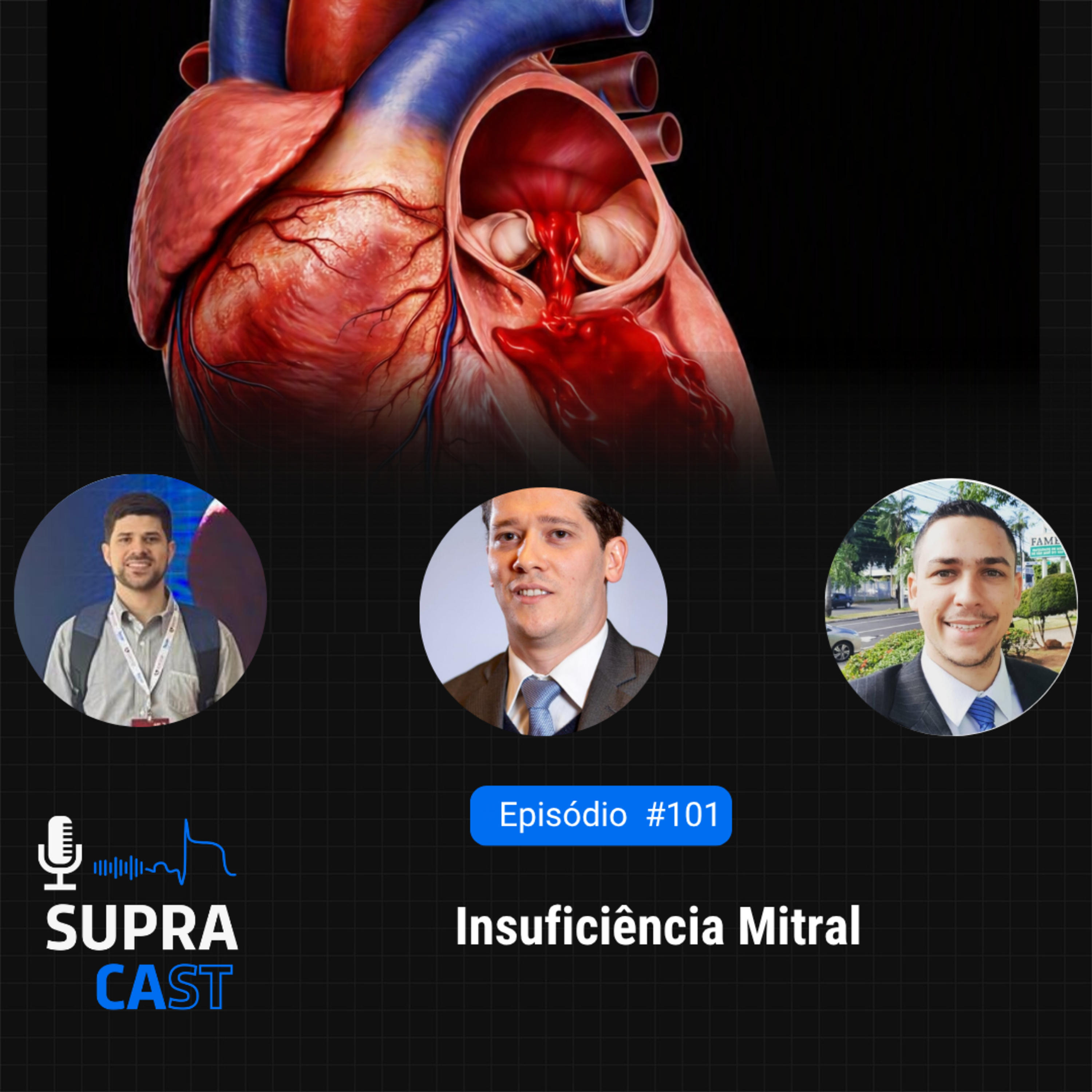 101. Insuficiência Mitral episode artwork