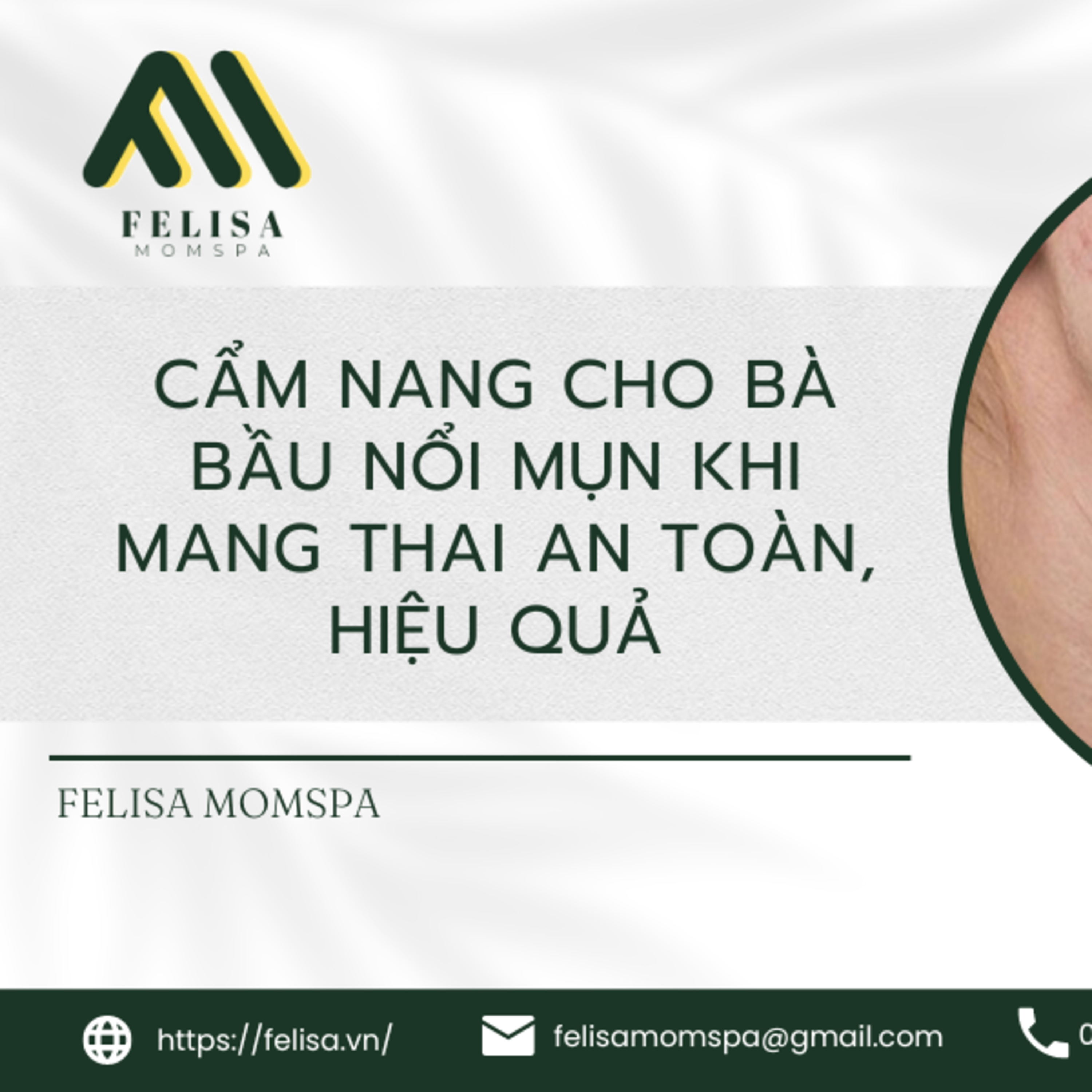 FELISA MOMSPA