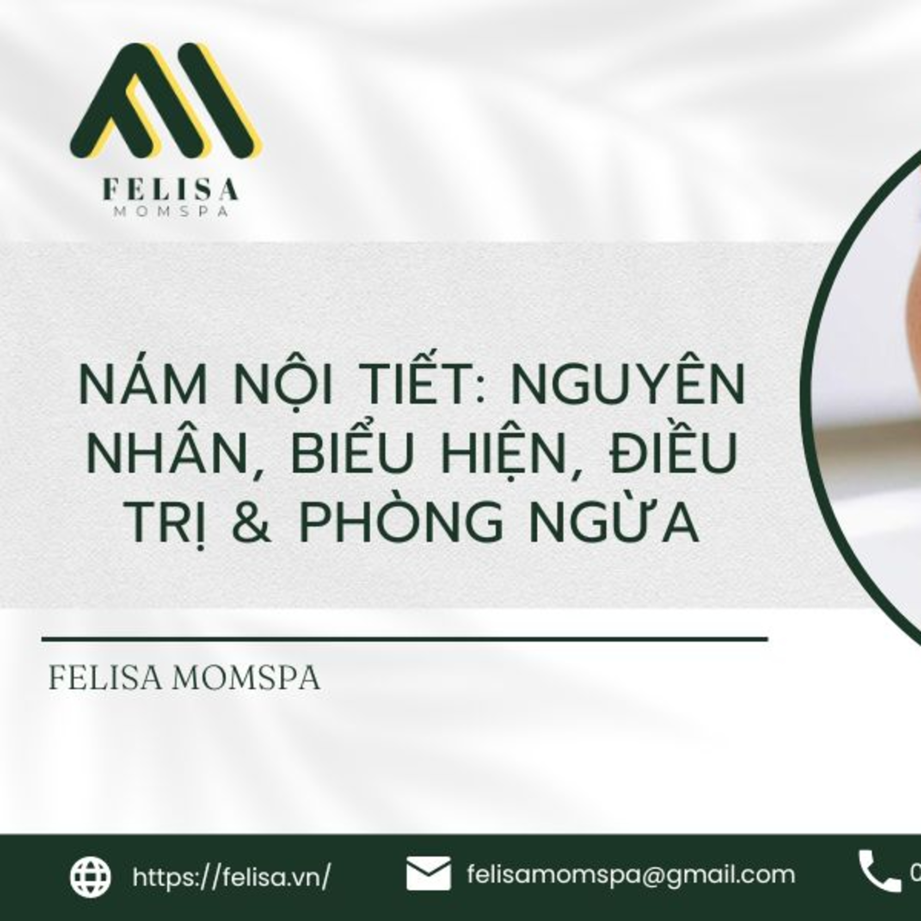 FELISA MOMSPA