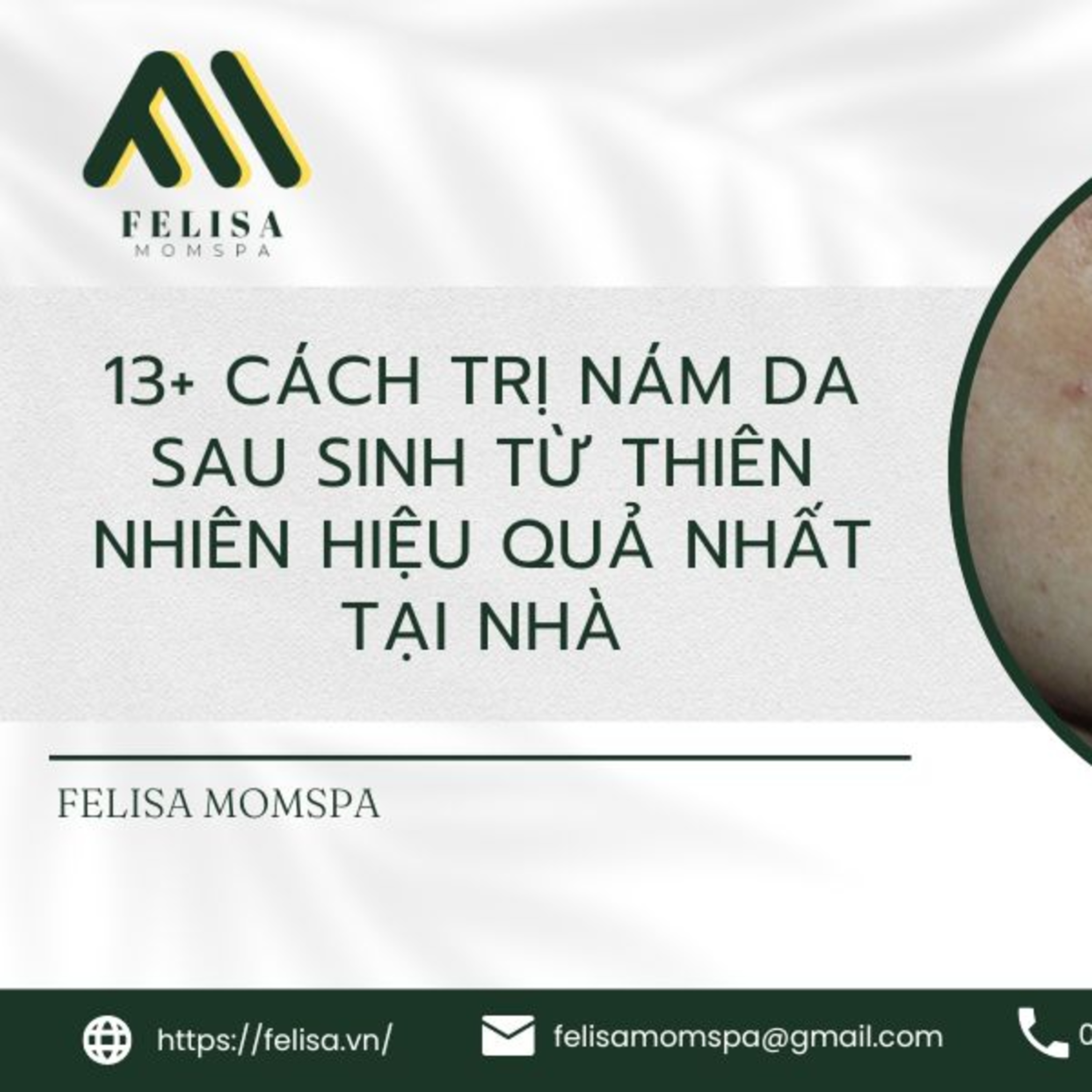FELISA MOMSPA