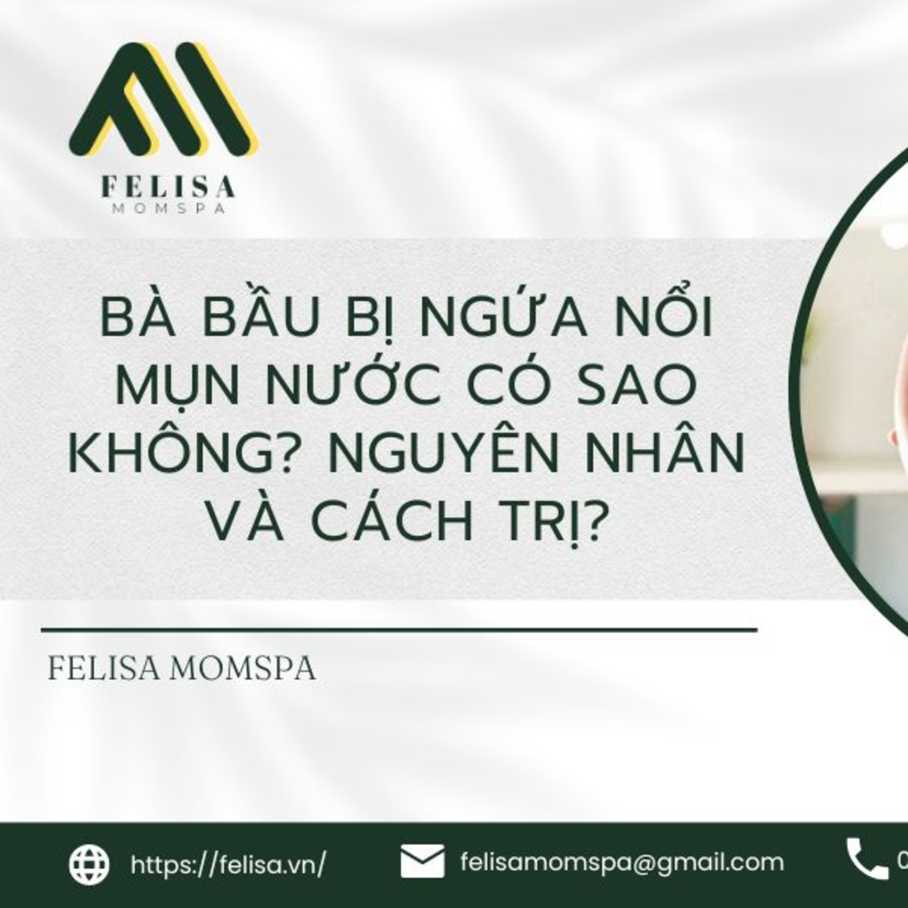 FELISA MOMSPA