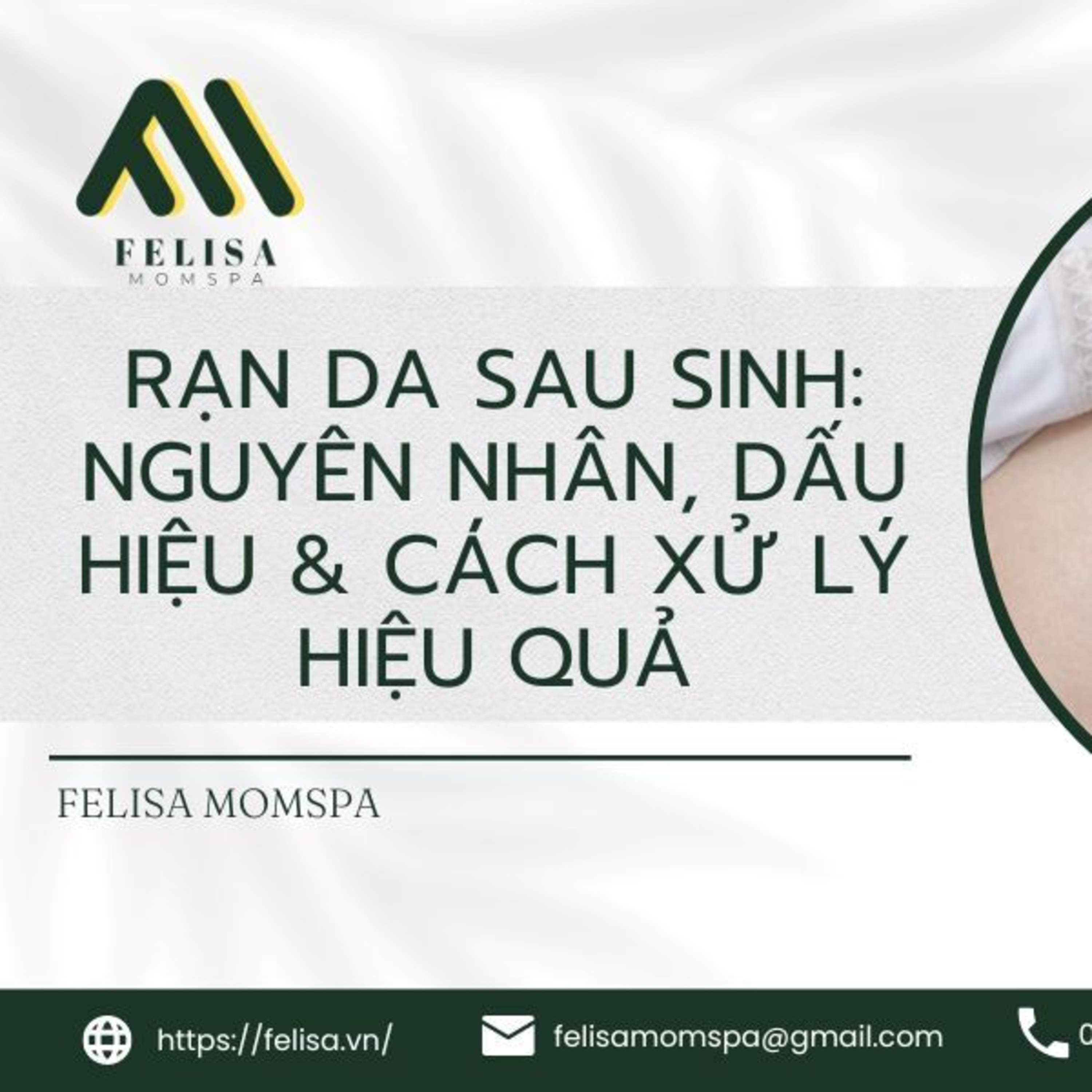 FELISA MOMSPA