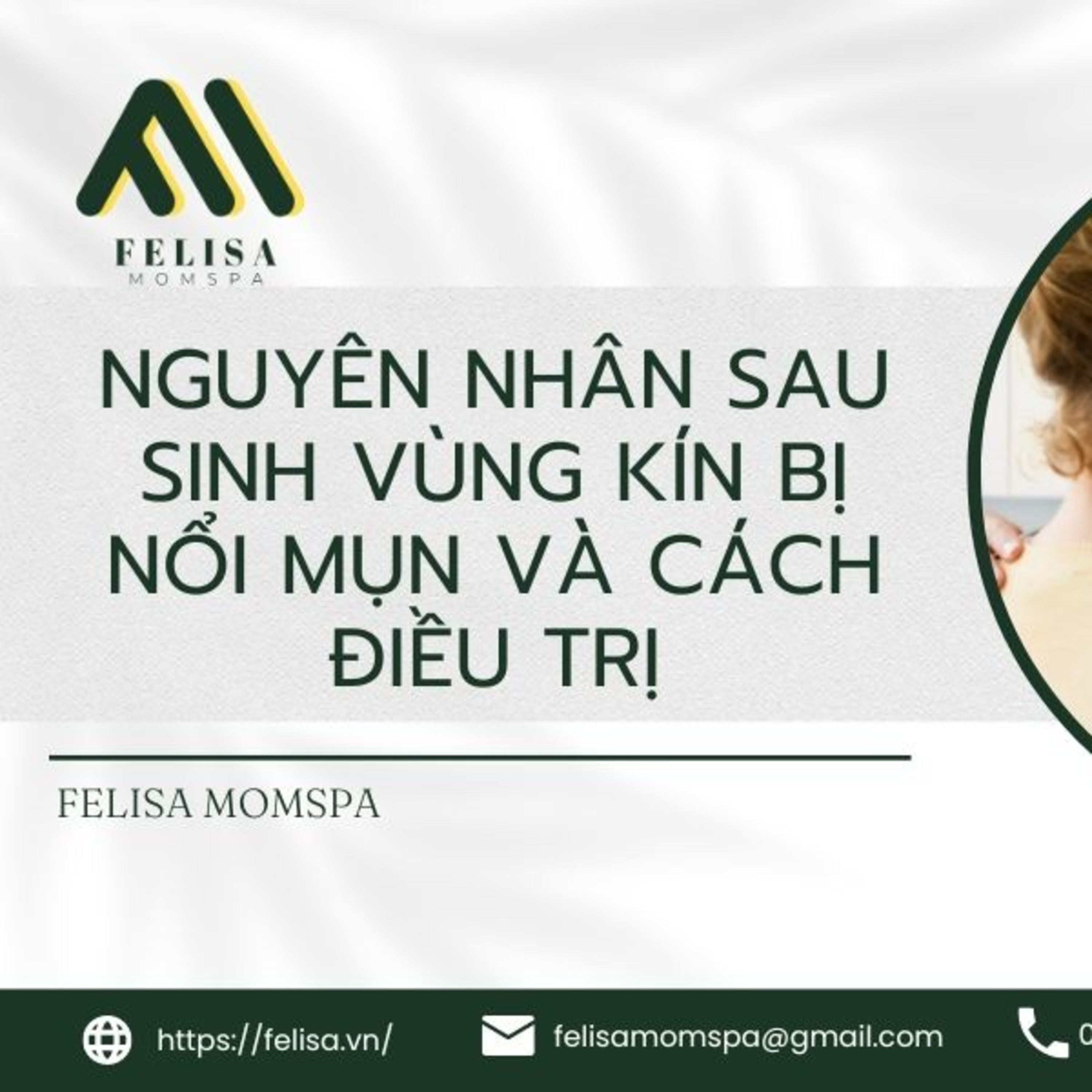 FELISA MOMSPA
