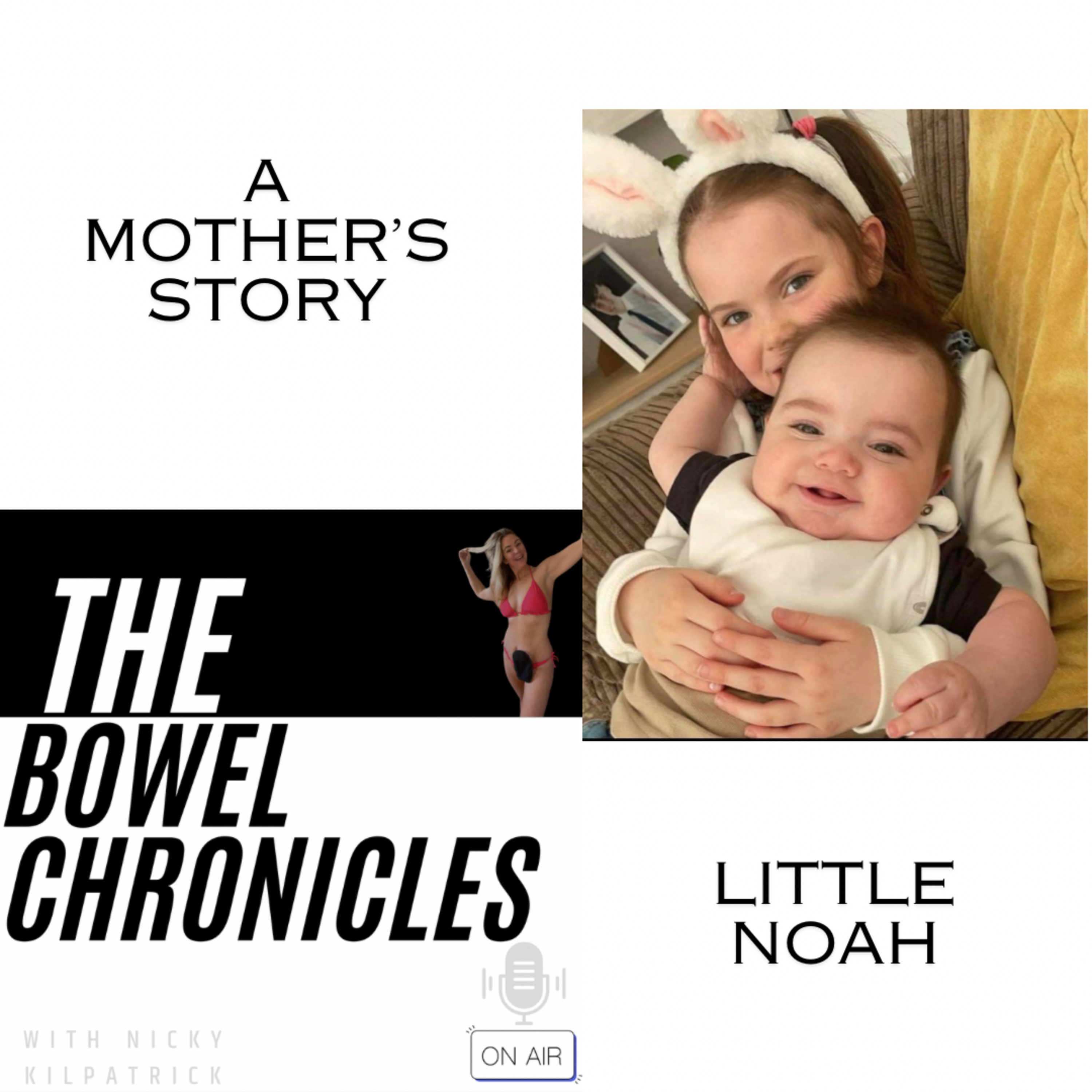 The Bowel Chronicles