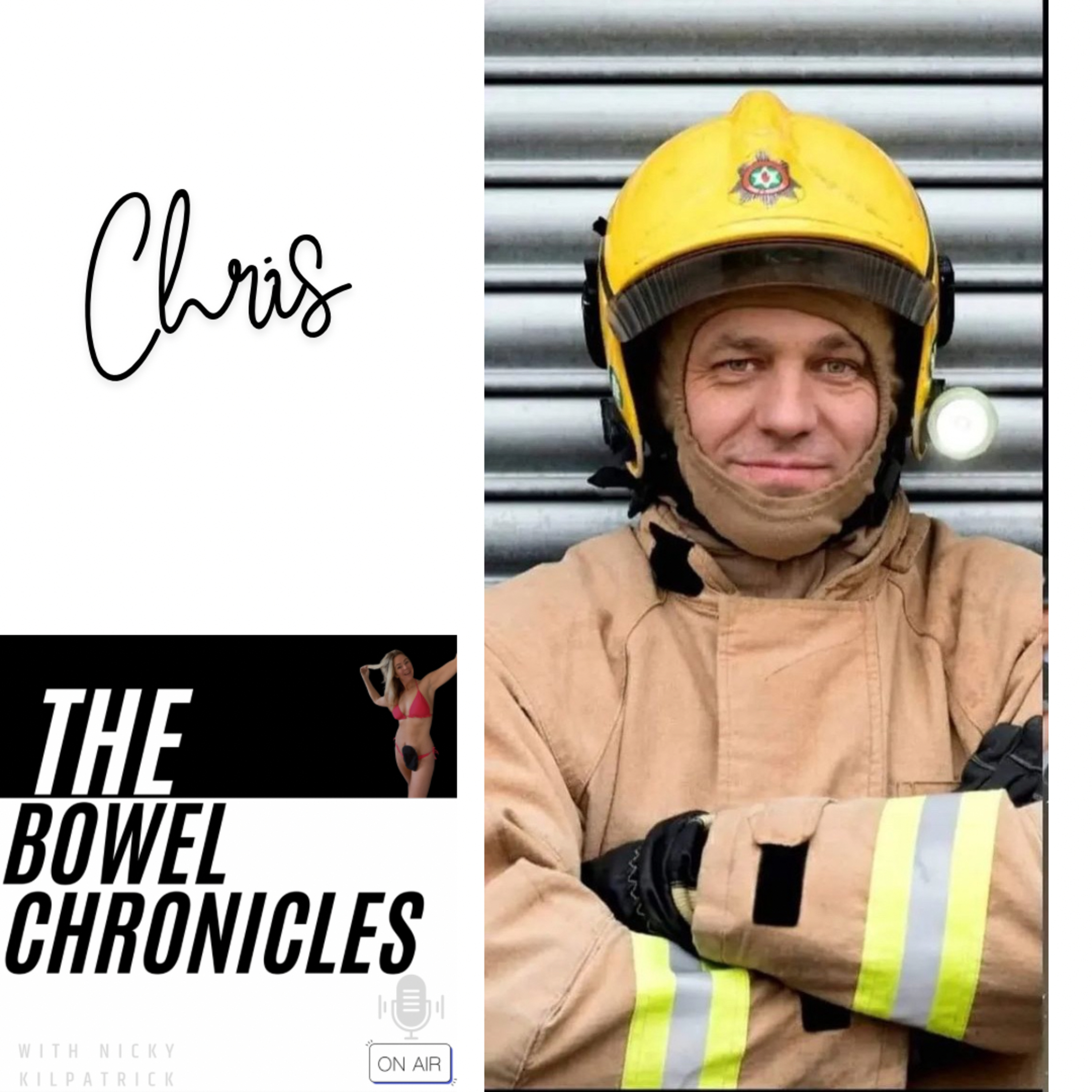 The Bowel Chronicles