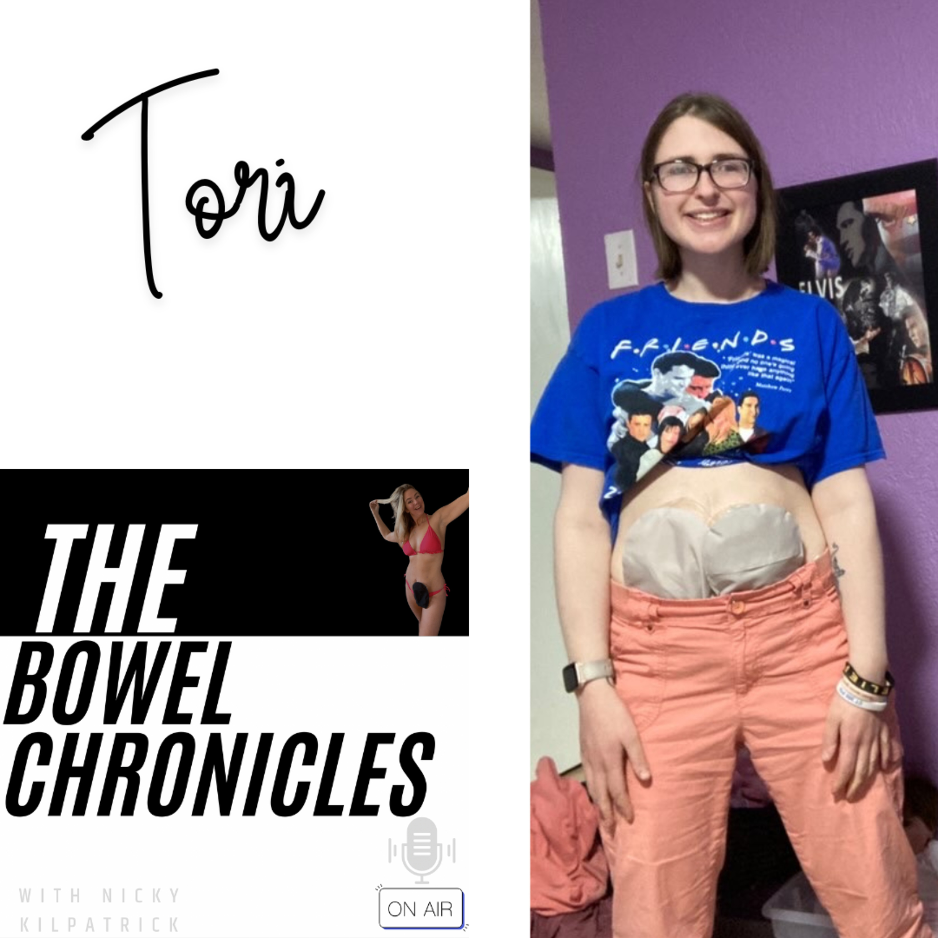The Bowel Chronicles