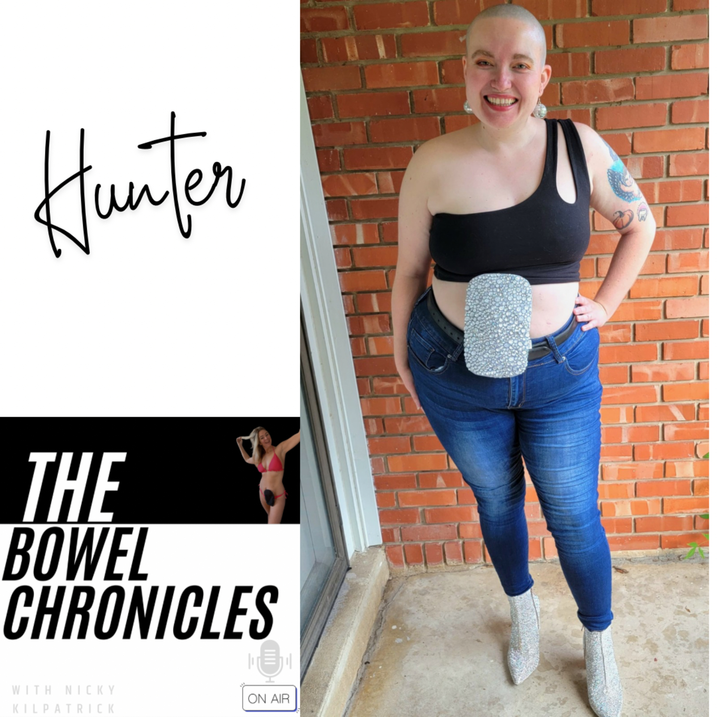 The Bowel Chronicles