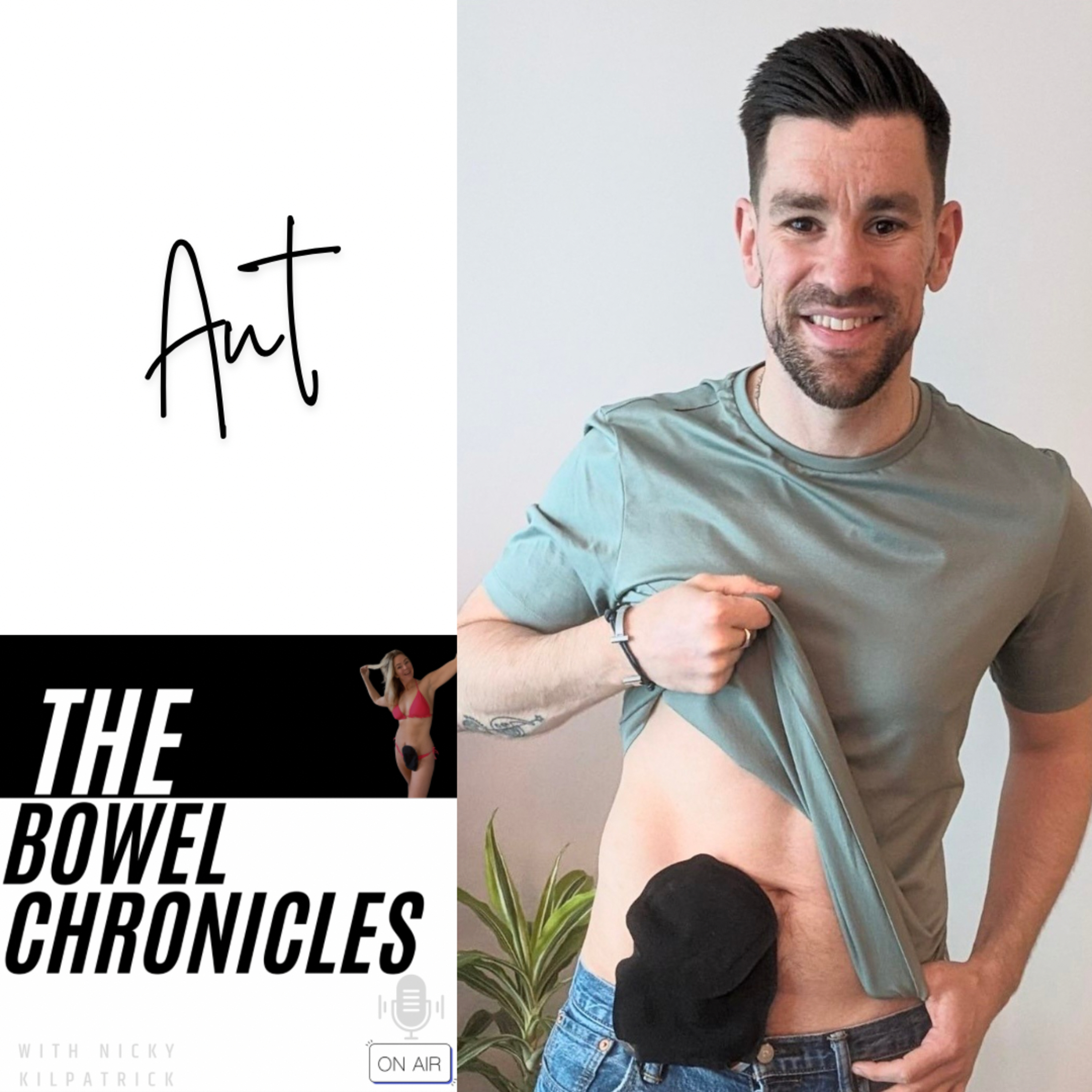 The Bowel Chronicles