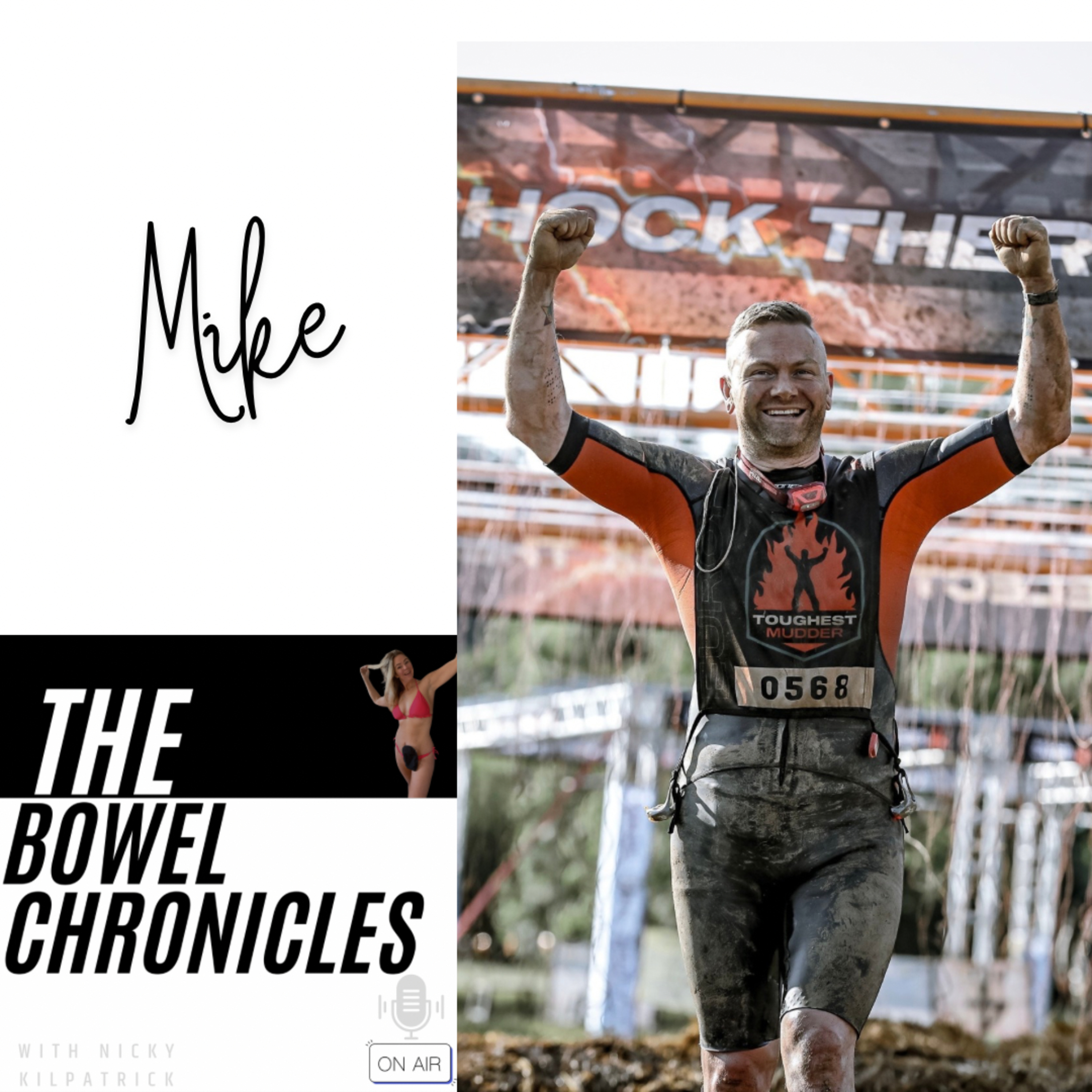 The Bowel Chronicles